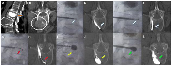 Curroncol 30 00324 g003