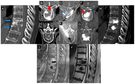 Curroncol 30 00324 g004