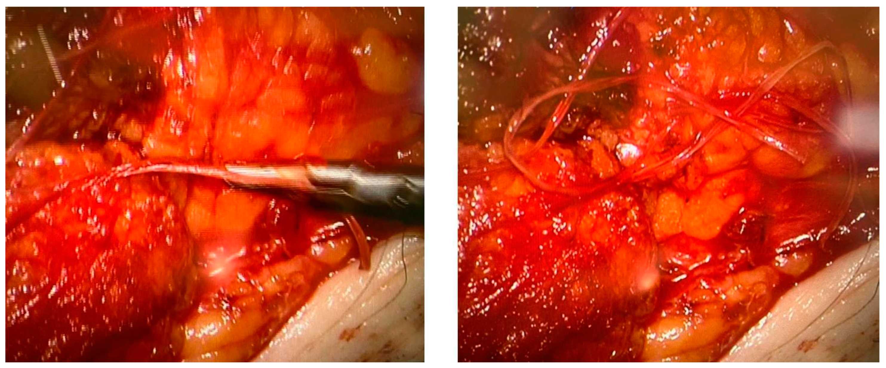 Curroncol 30 00341 g004 Curroncol 30 00341 g004