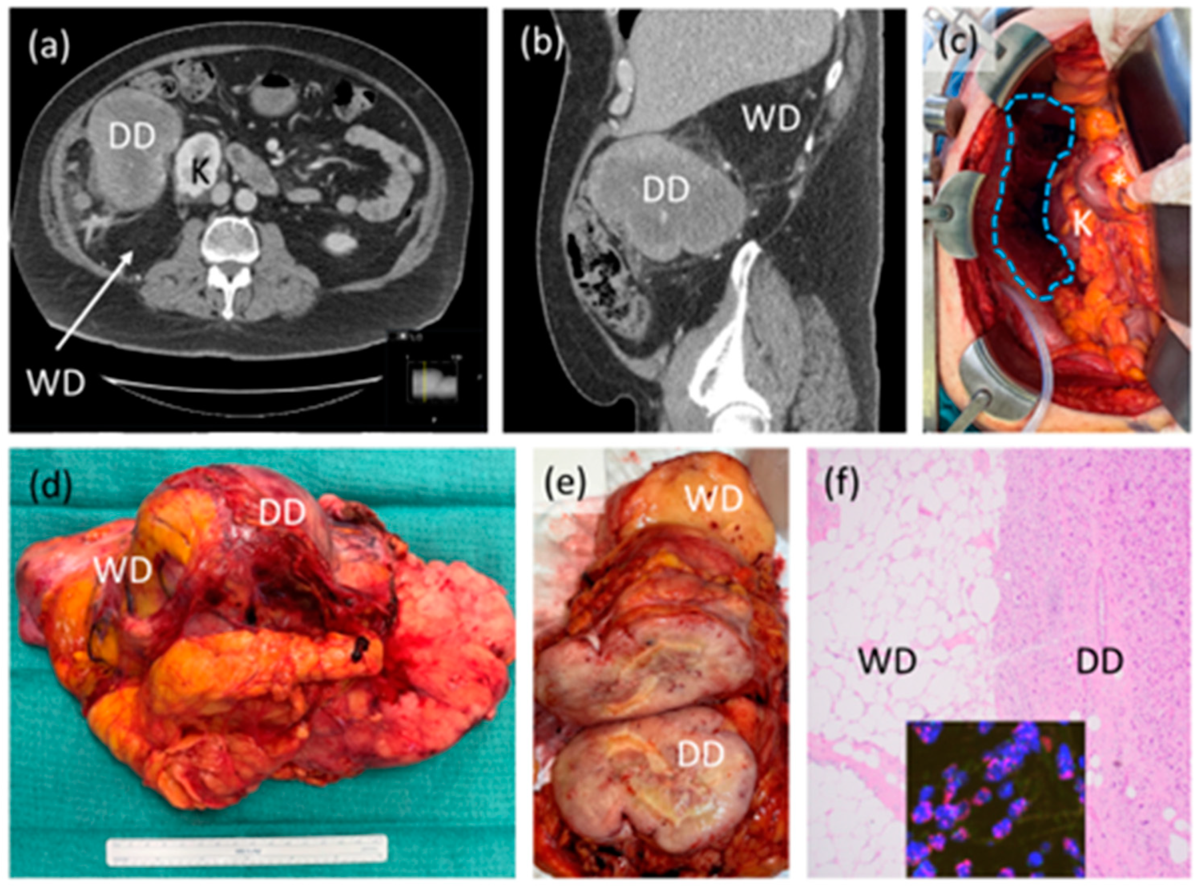 Curroncol 30 00349 g001 Curroncol 30 00349 g001