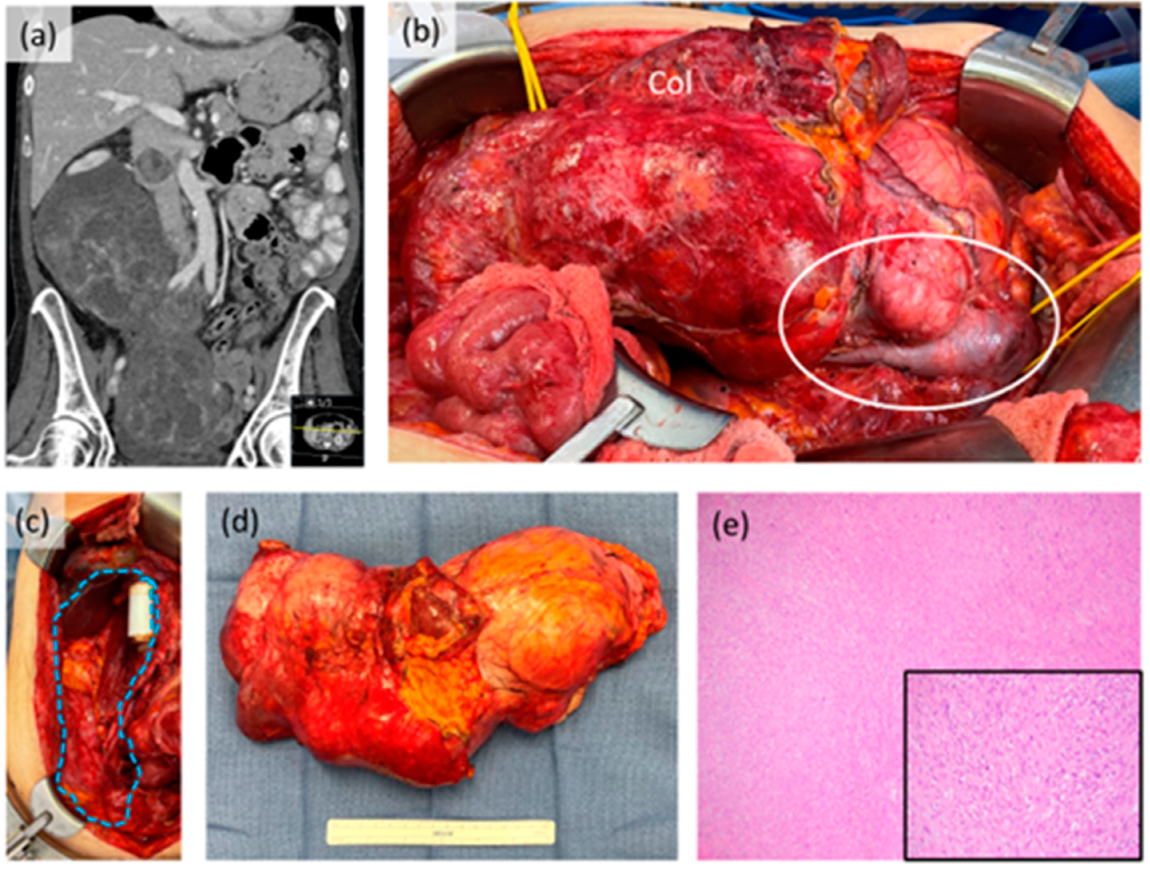 Curroncol 30 00349 g002 Curroncol 30 00349 g002