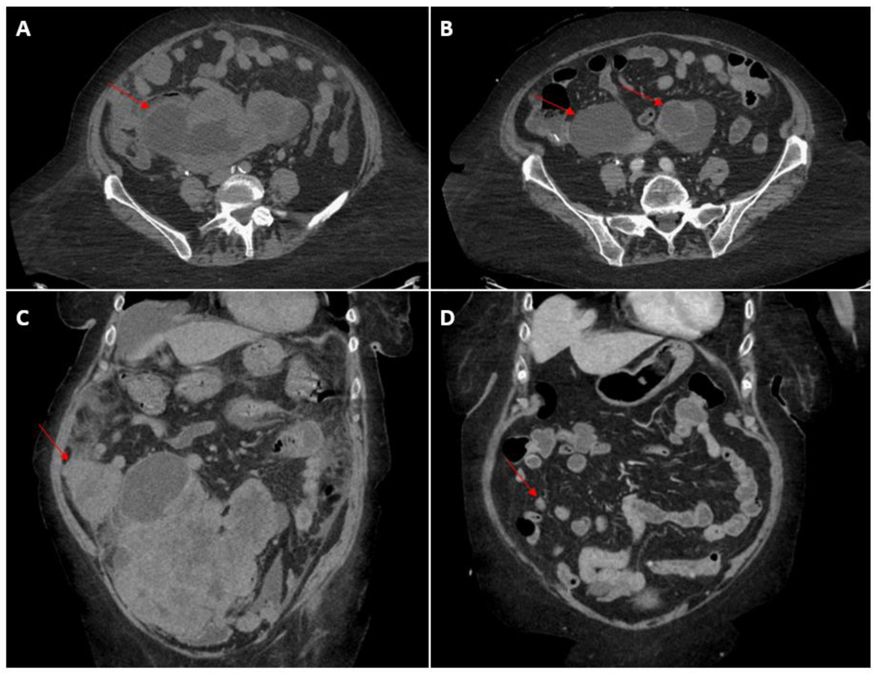 Curroncol 30 00369 g003