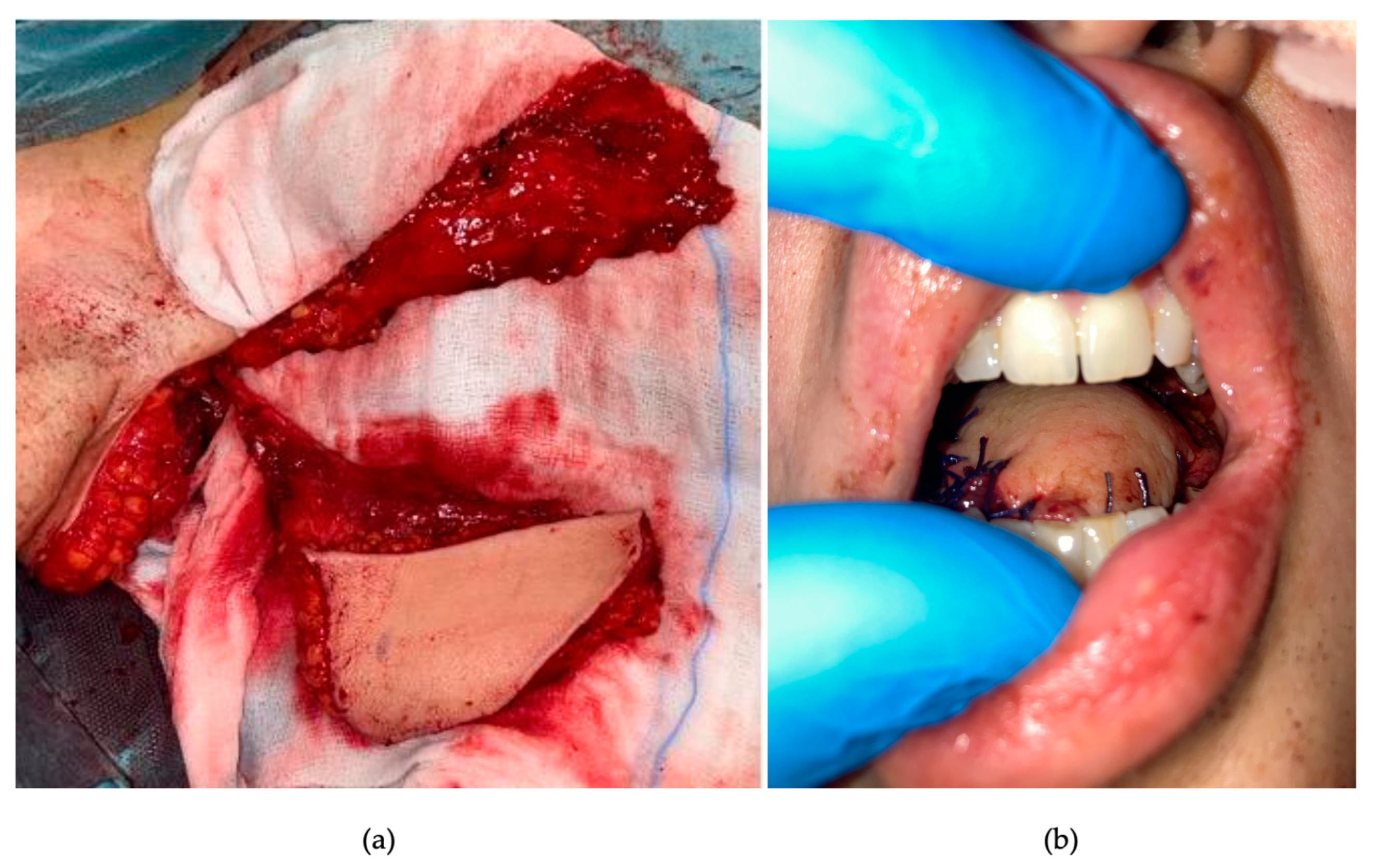 Curroncol 30 00492 g005