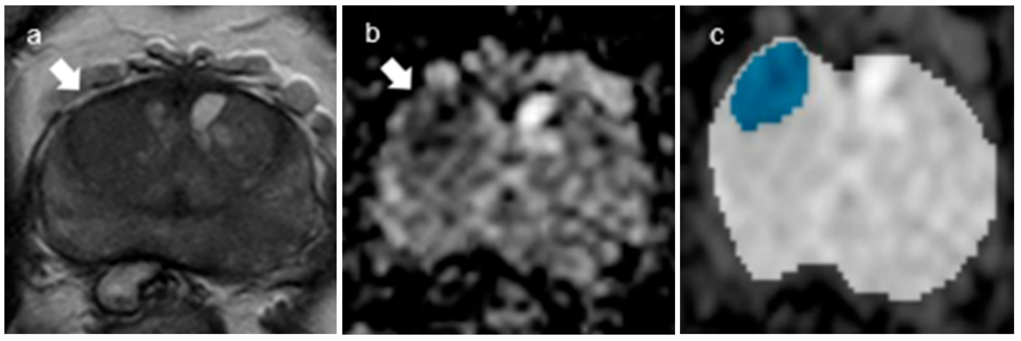 Curroncol 30 00528 g005 Curroncol 30 00528 g005