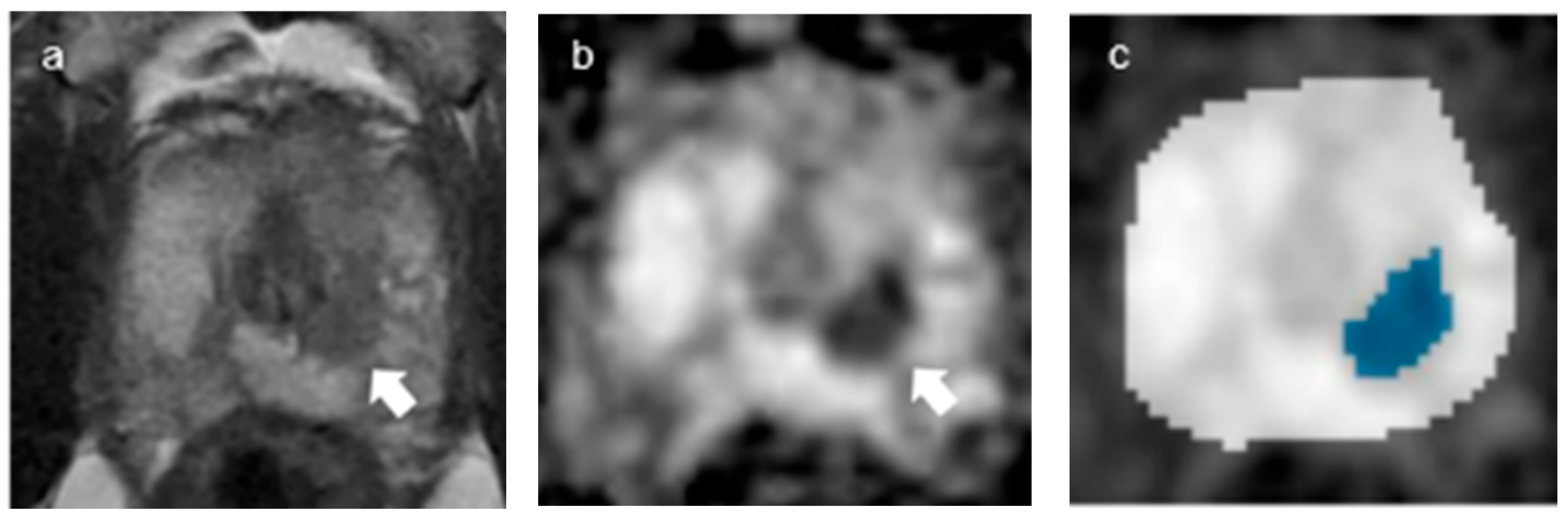 Curroncol 30 00528 g006 Curroncol 30 00528 g006
