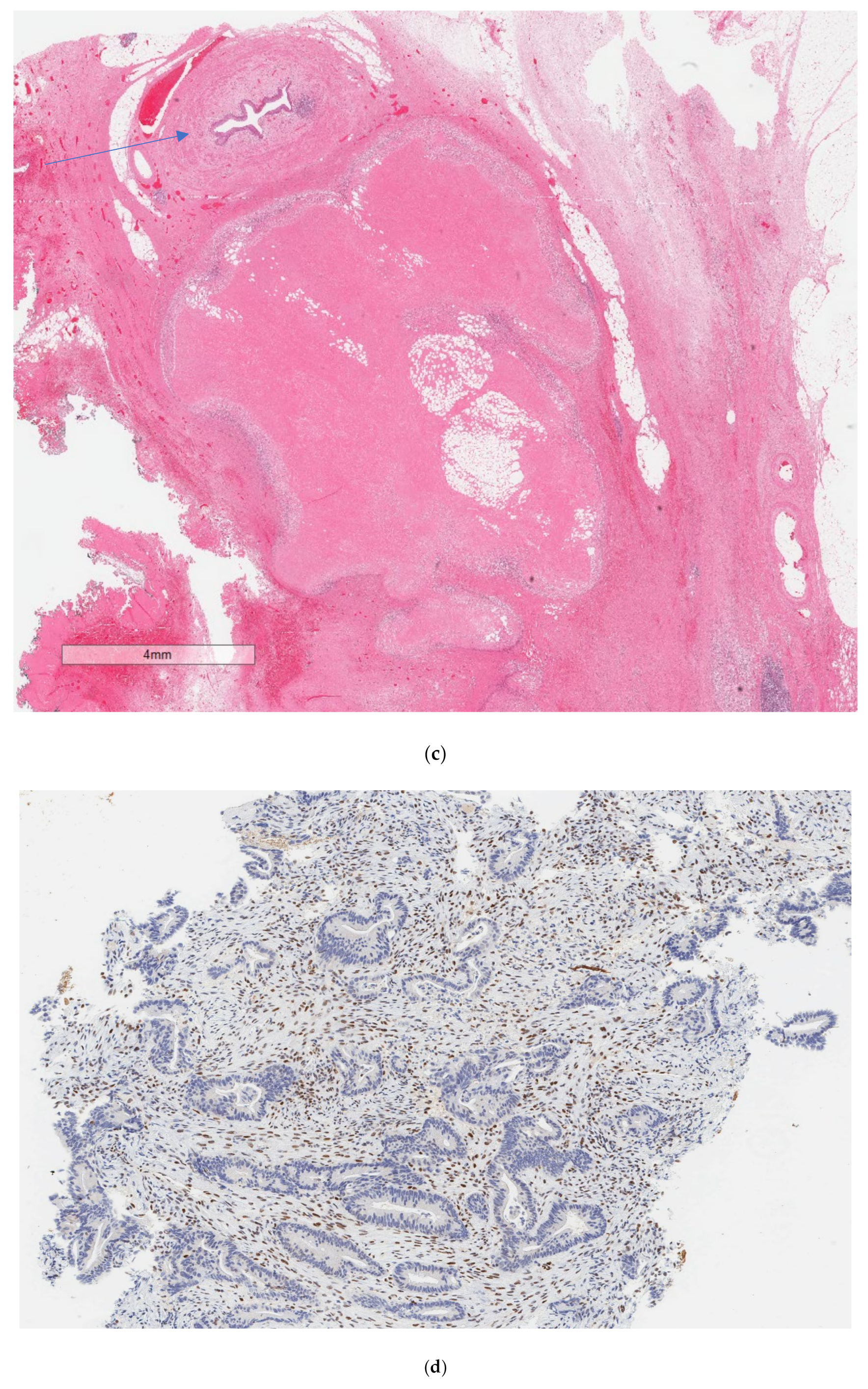 Curroncol 30 00653 g002b