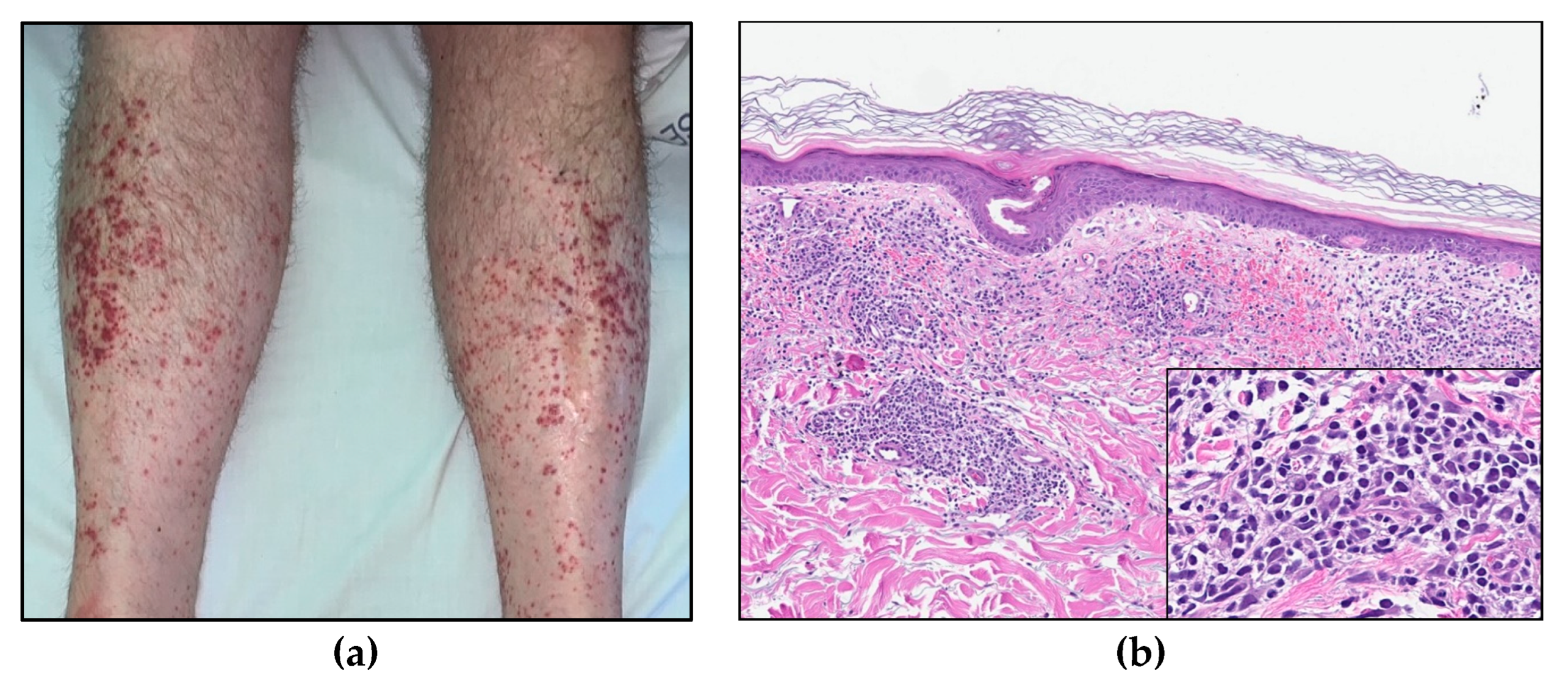 Curroncol 30 00727 g007 Curroncol 30 00727 g007