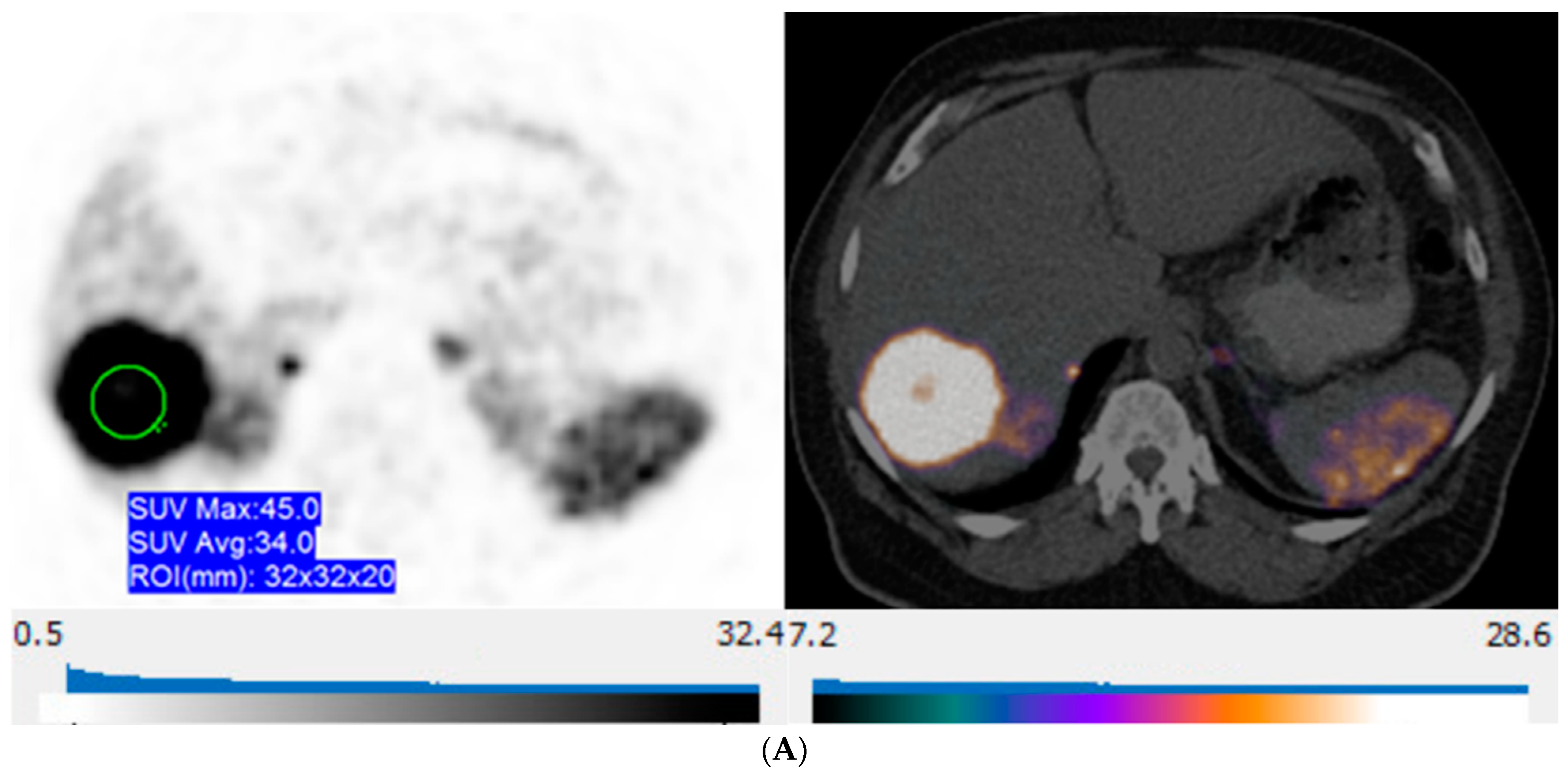 Curroncol 31 00036 g005a