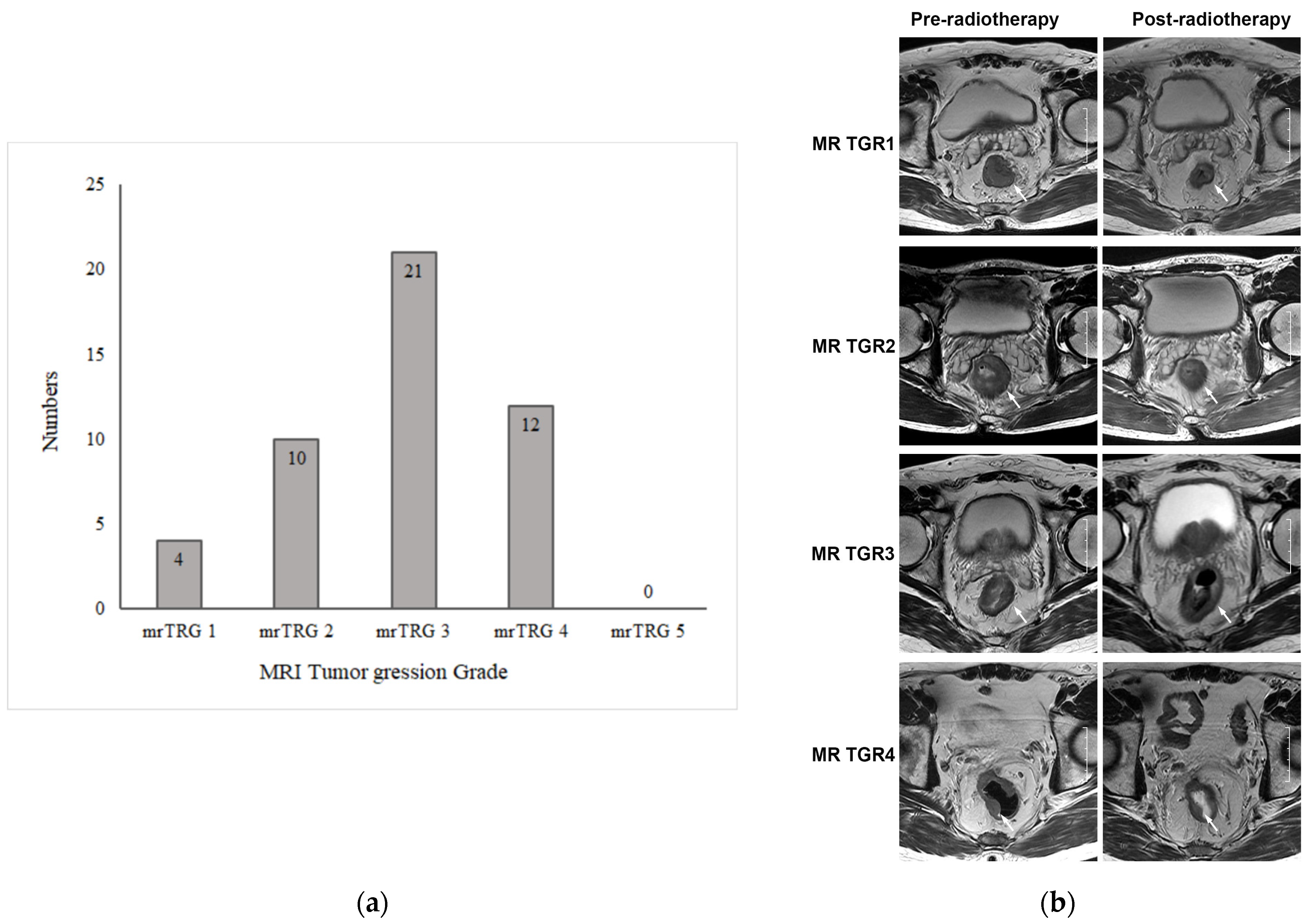 Curroncol 31 00037 g002 Curroncol 31 00037 g002