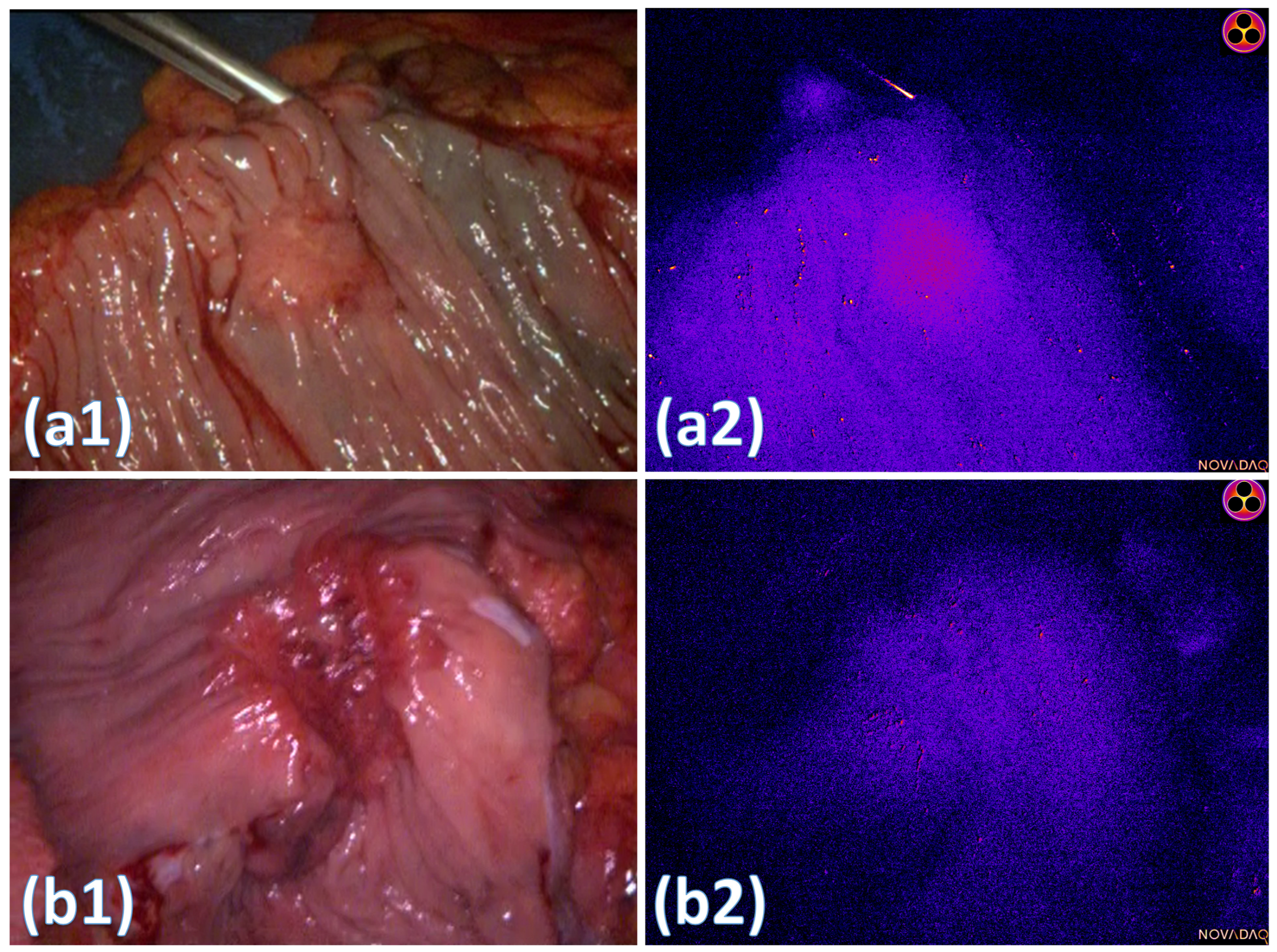 Curroncol 31 00063 g002