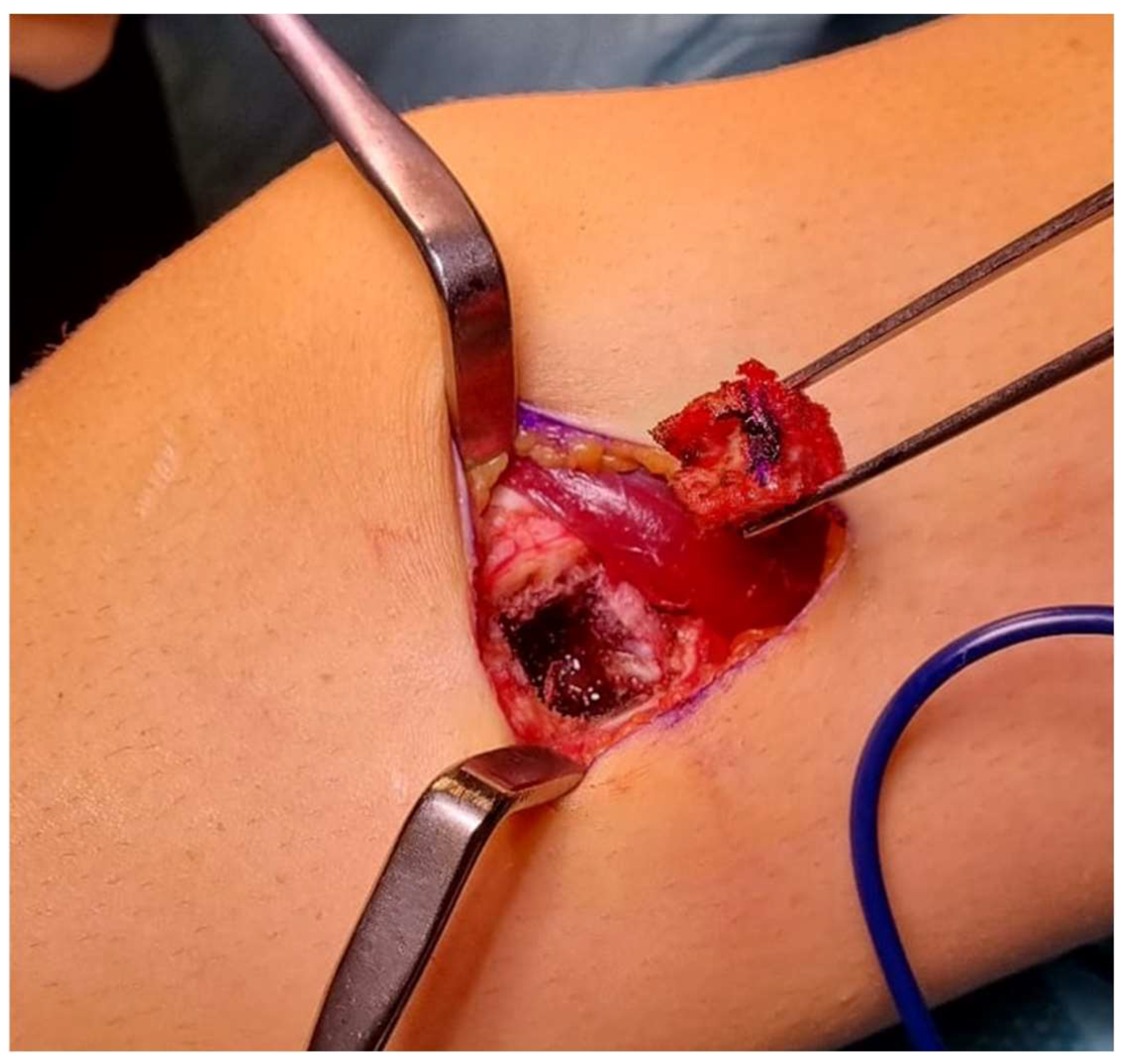 Curroncol 31 00067 g002