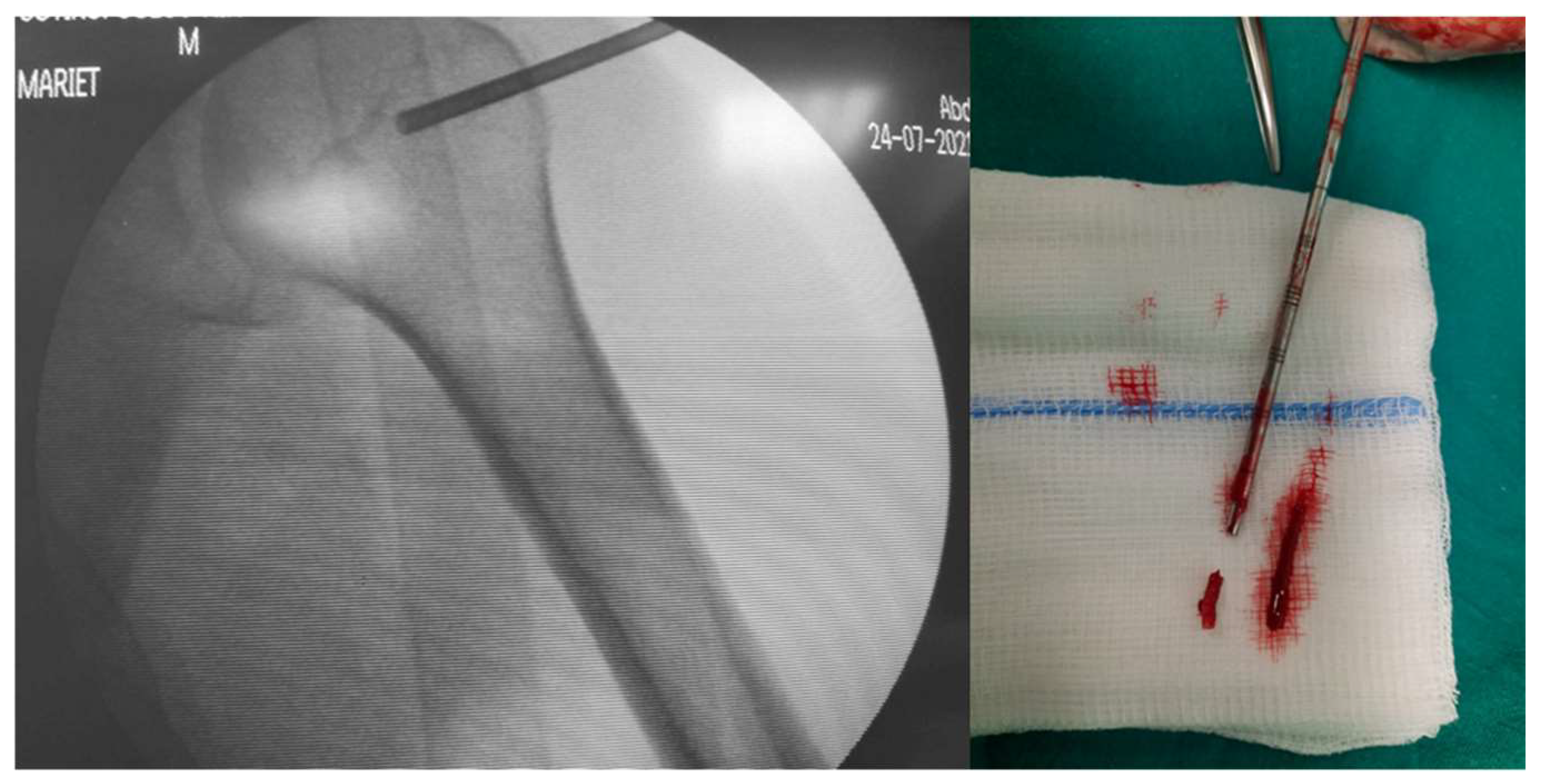 Curroncol 31 00067 g003