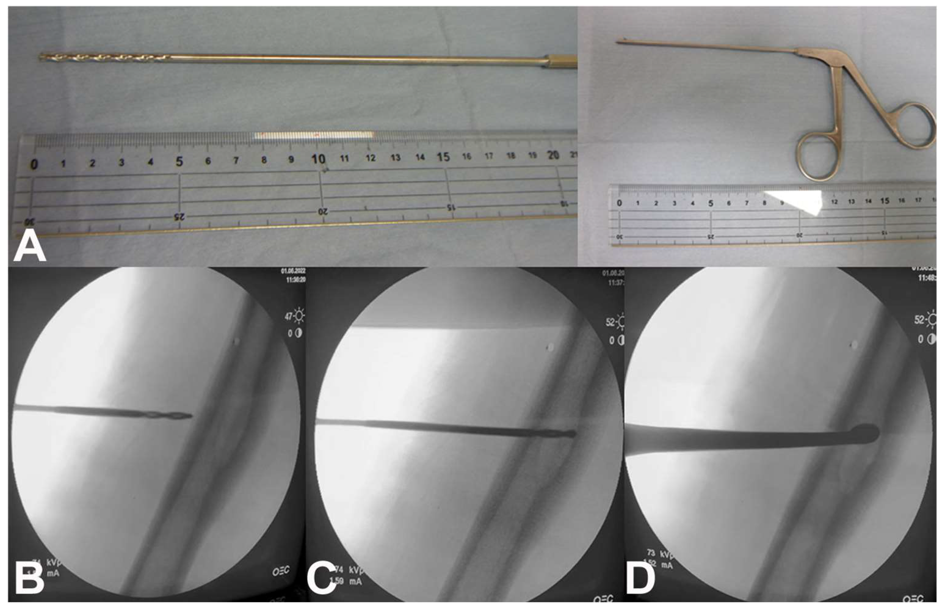 Curroncol 31 00067 g004