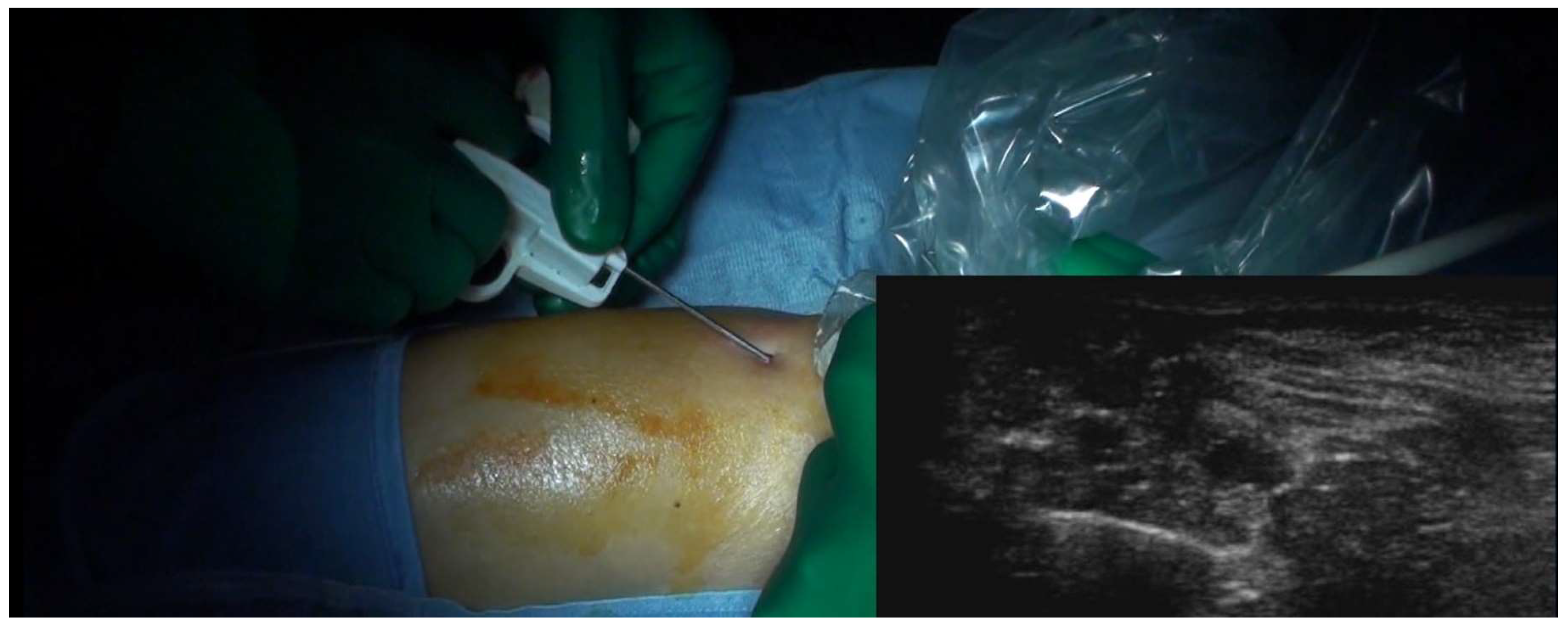 Curroncol 31 00067 g005