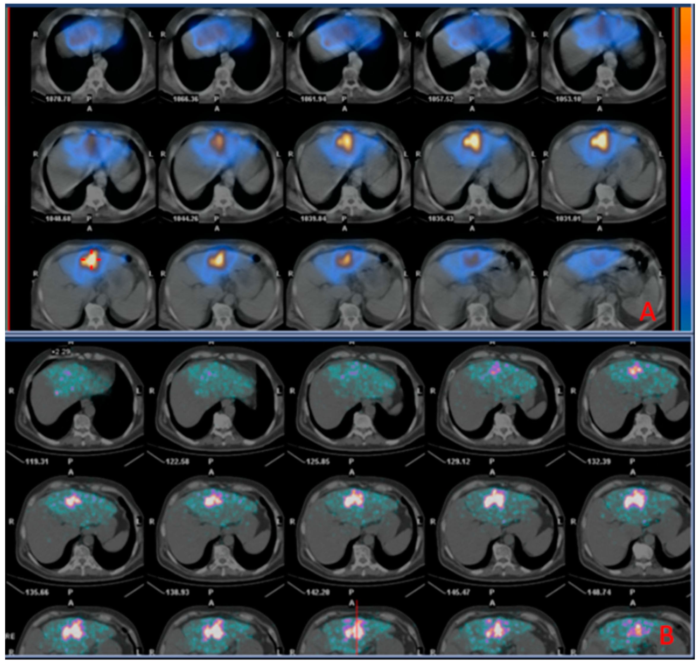 Curroncol 31 00114 g004