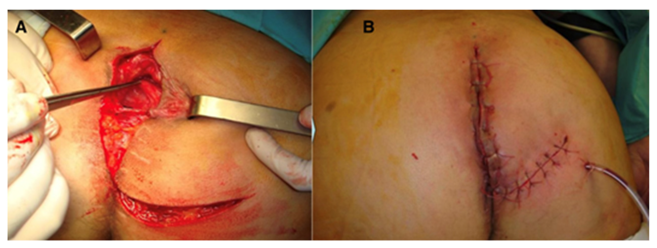 Curroncol 31 00247 g003