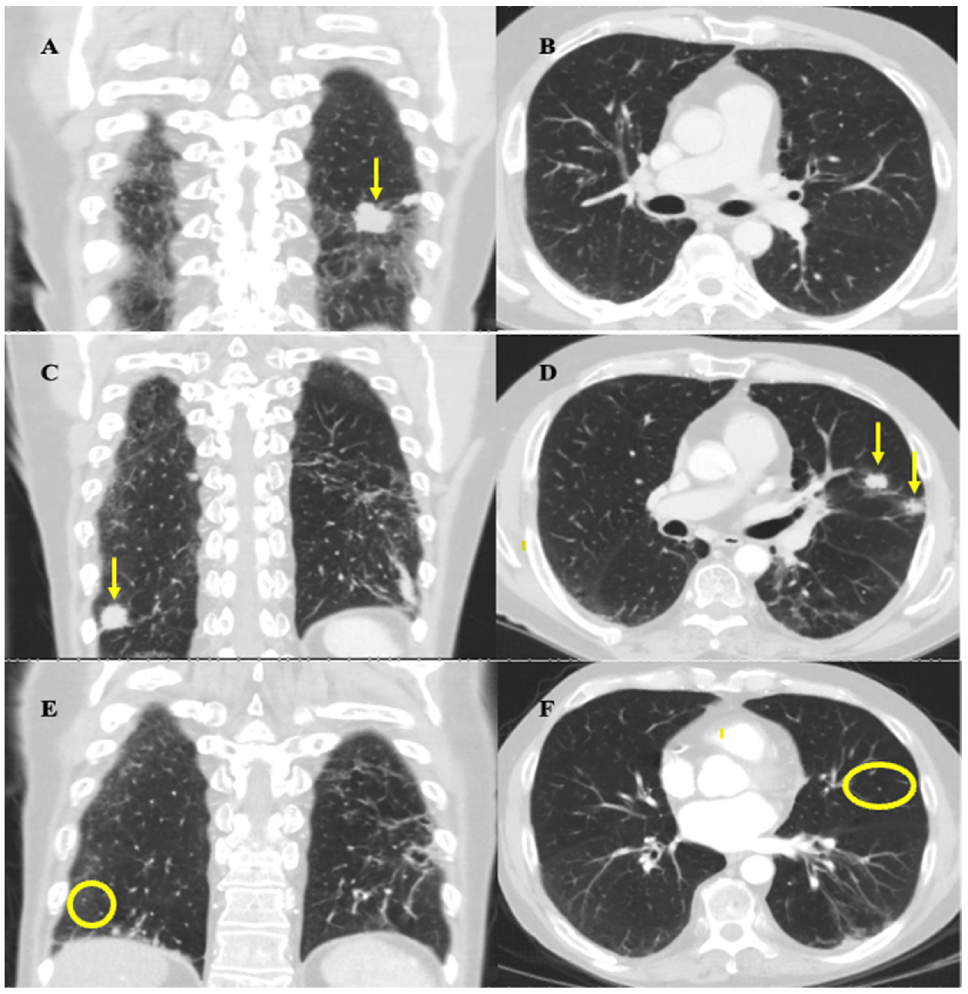 Curroncol 31 00271 g002