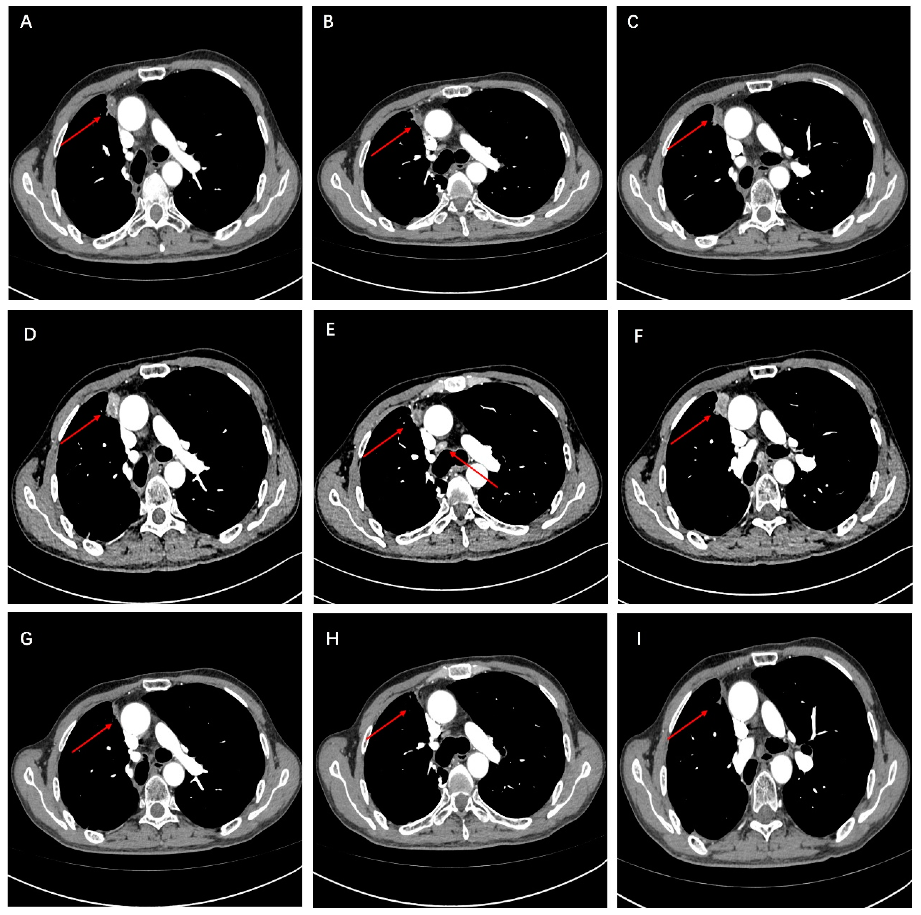 Curroncol 31 00281 g003