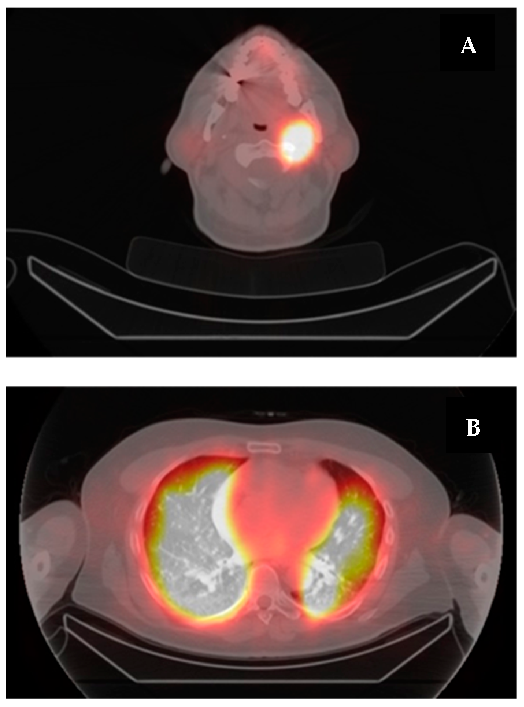 Curroncol 31 00286 g003 Curroncol 31 00286 g003