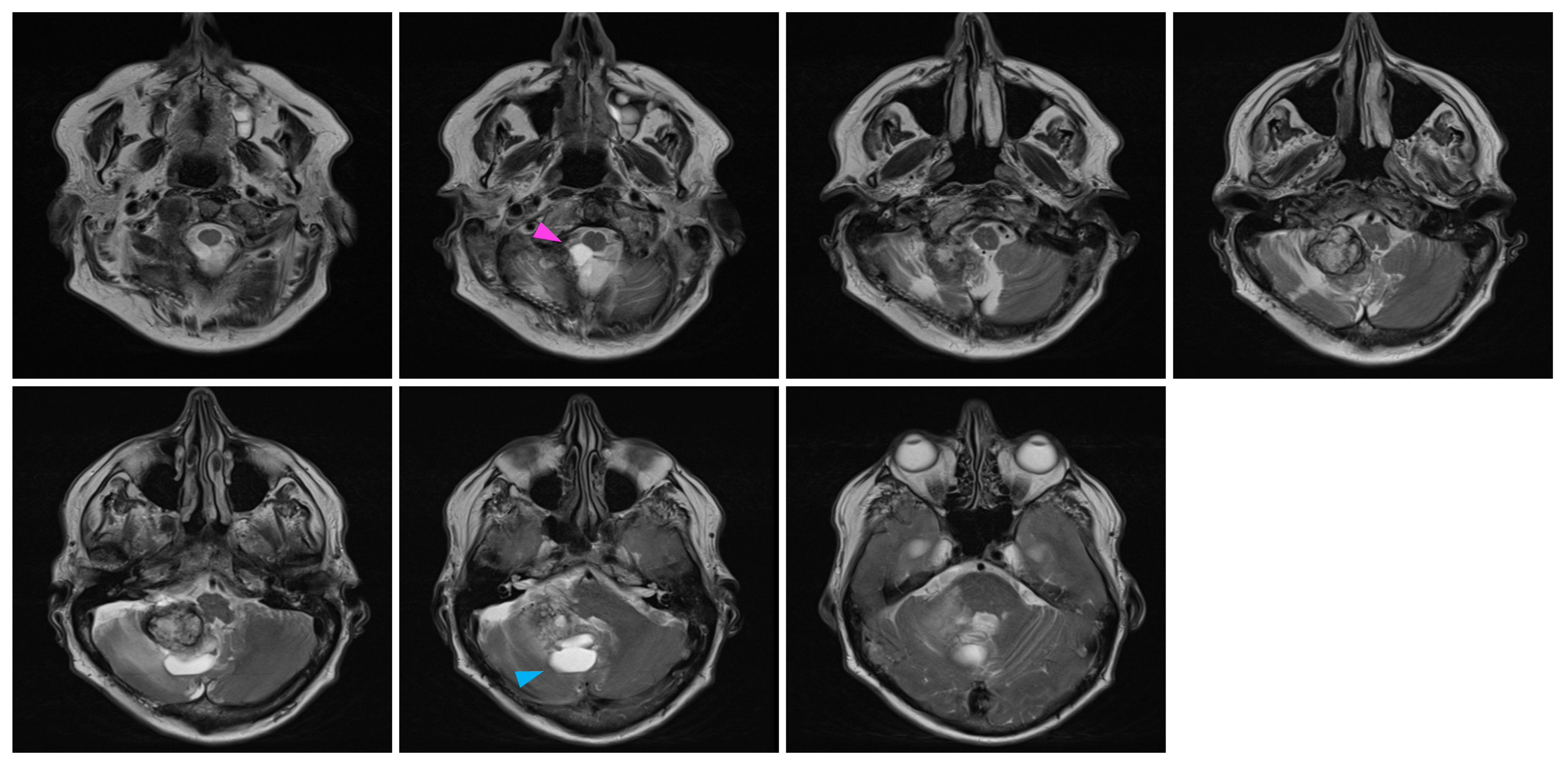 Curroncol 31 00293 g004