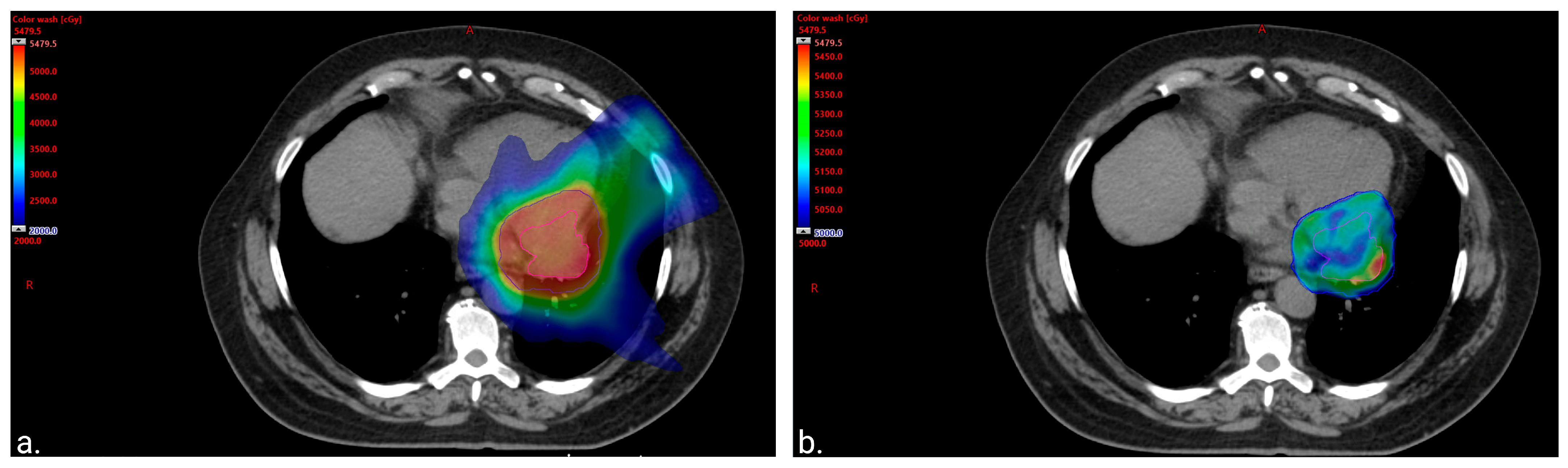Curroncol 31 00398 g002