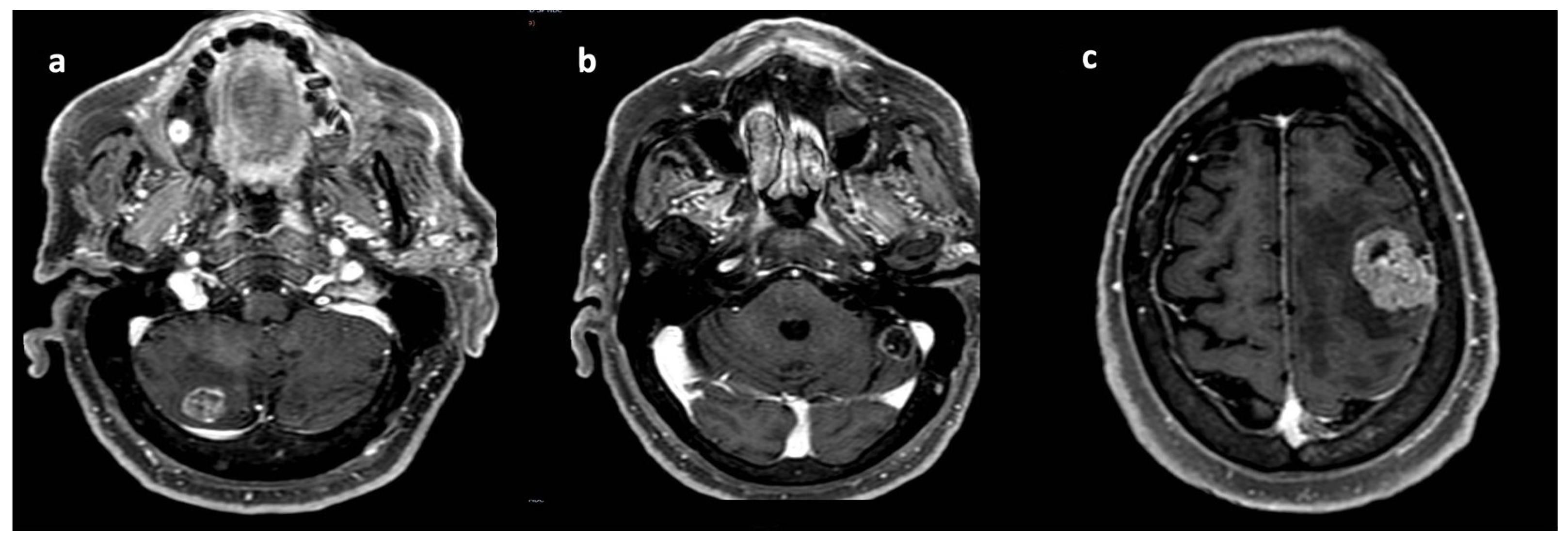 Curroncol 31 00598 g001