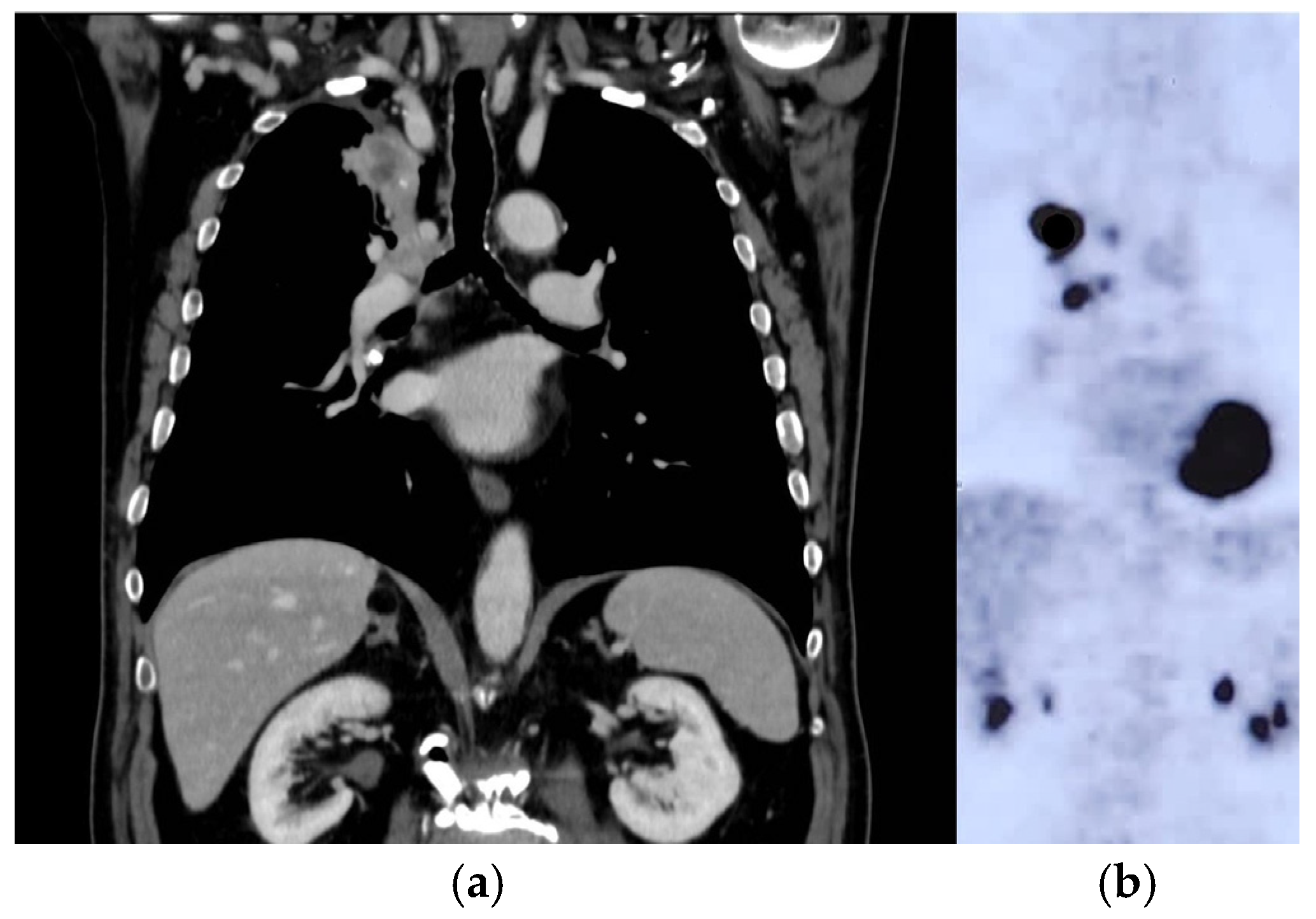 Curroncol 31 00598 g002