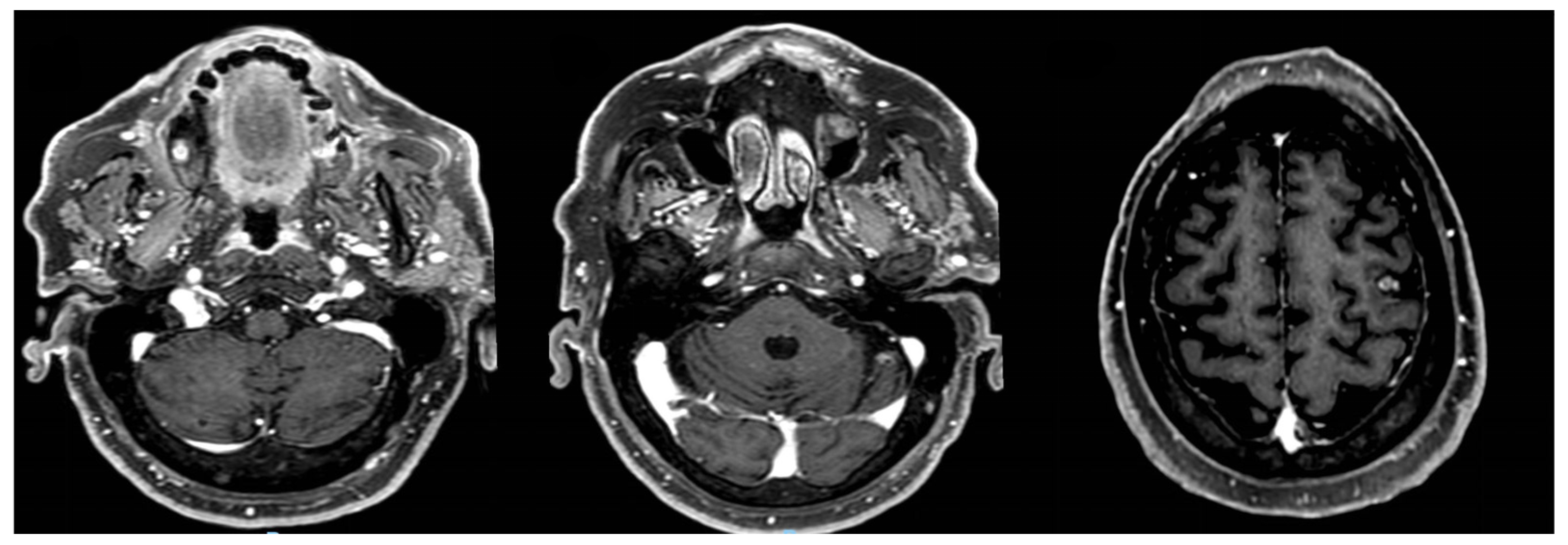 Curroncol 31 00598 g005