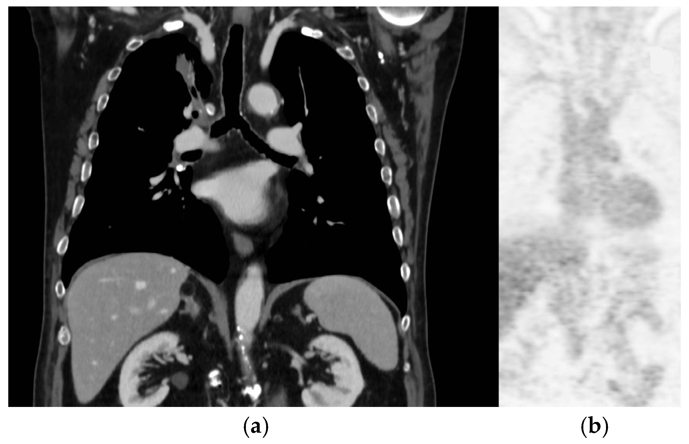 Curroncol 31 00598 g006