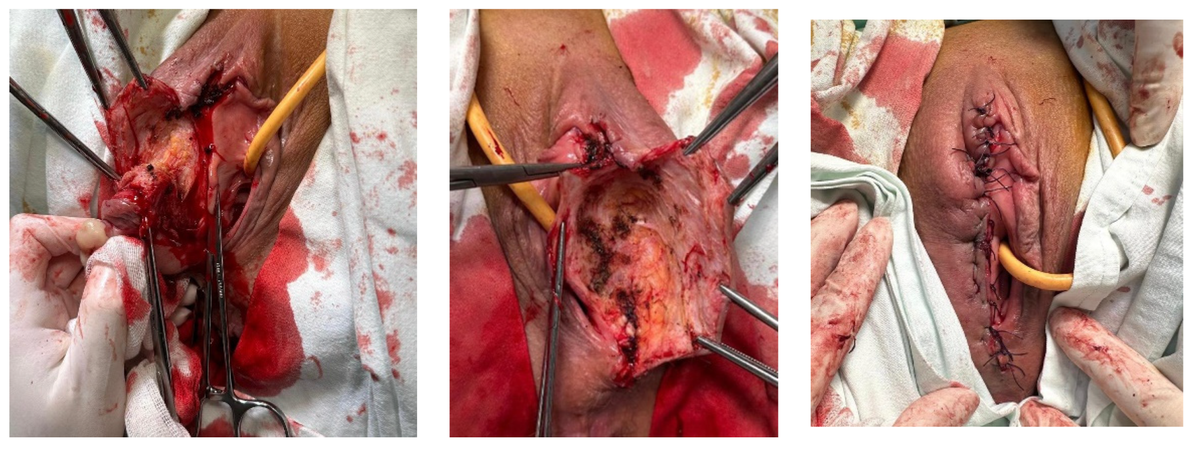 Curroncol 32 00004 g005