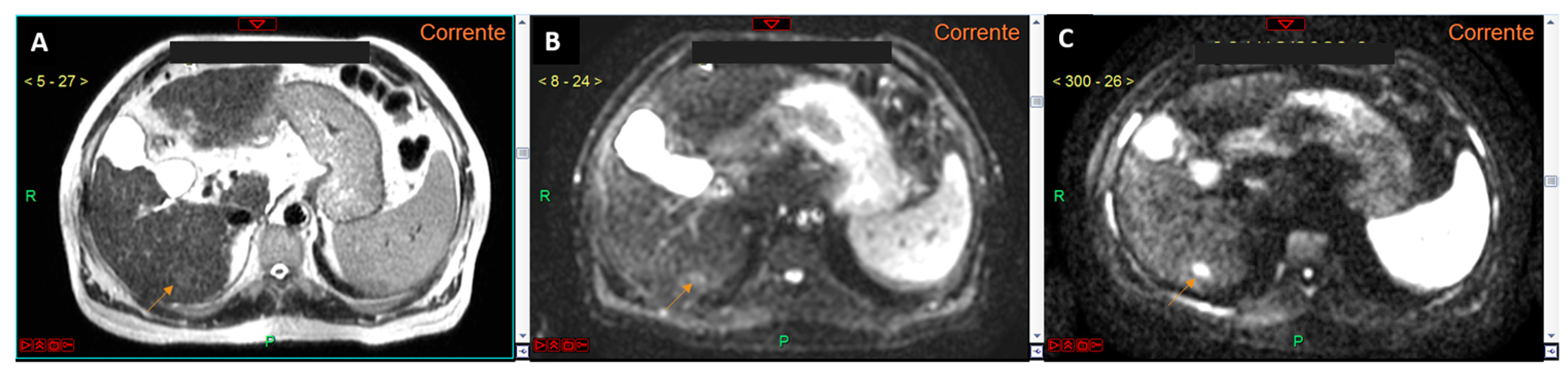 Curroncol 32 00040 g003