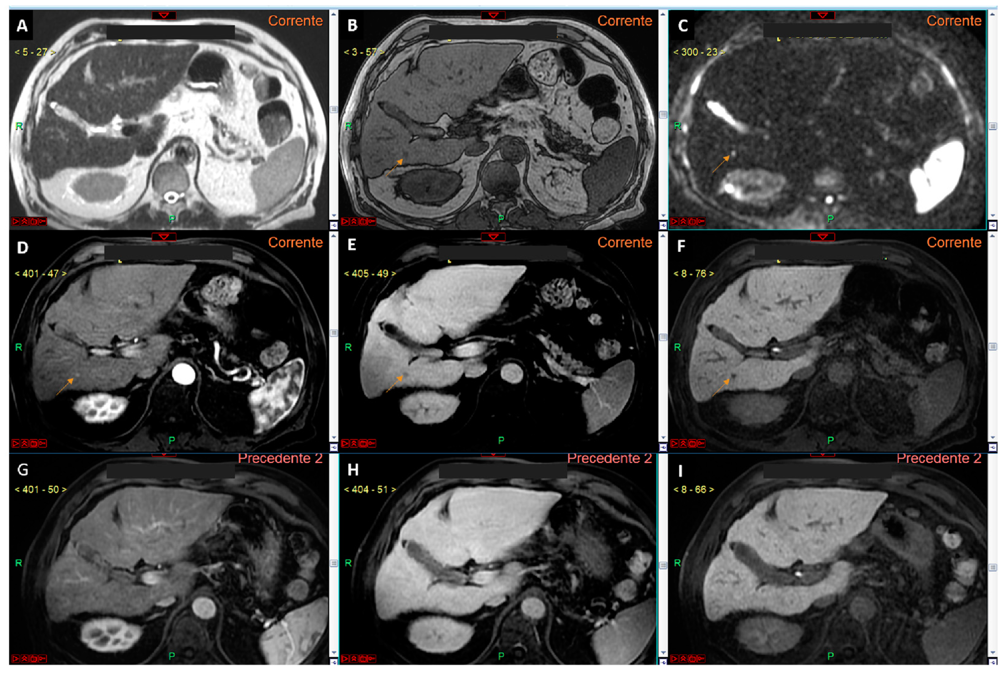 Curroncol 32 00040 g004
