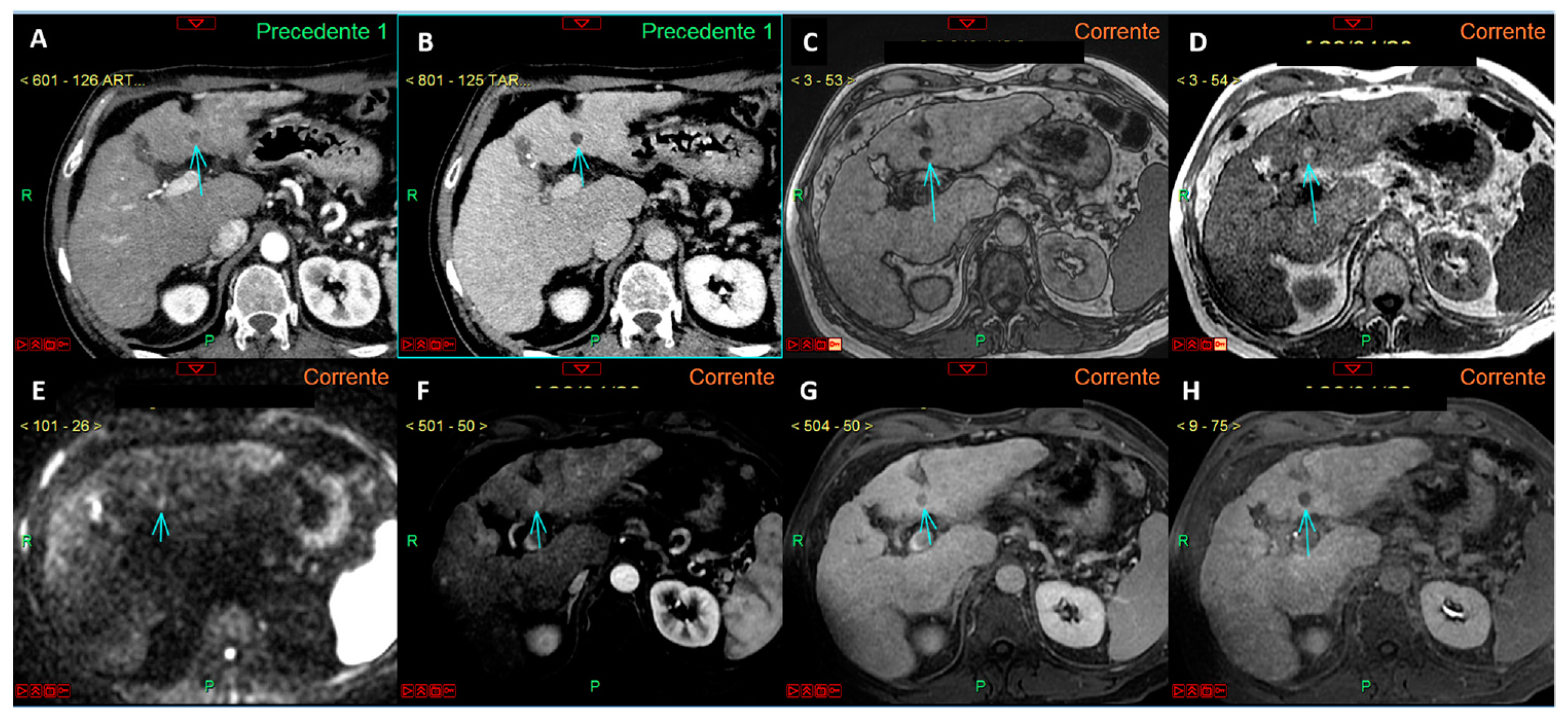 Curroncol 32 00040 g005