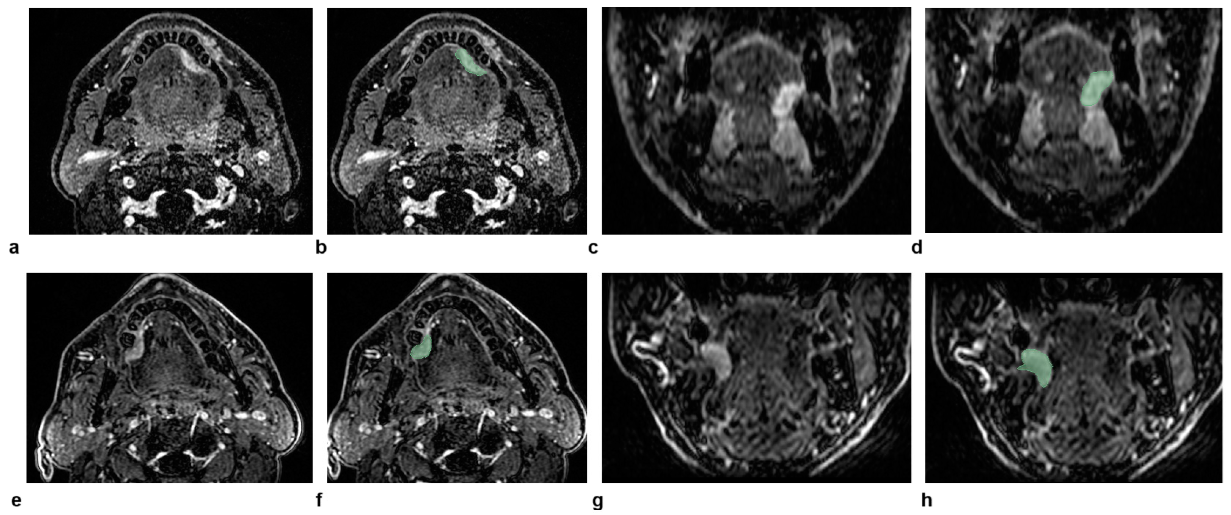 Curroncol 32 00116 g004