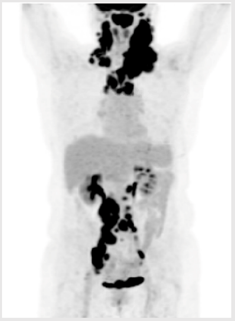 Curroncol 32 00142 i001