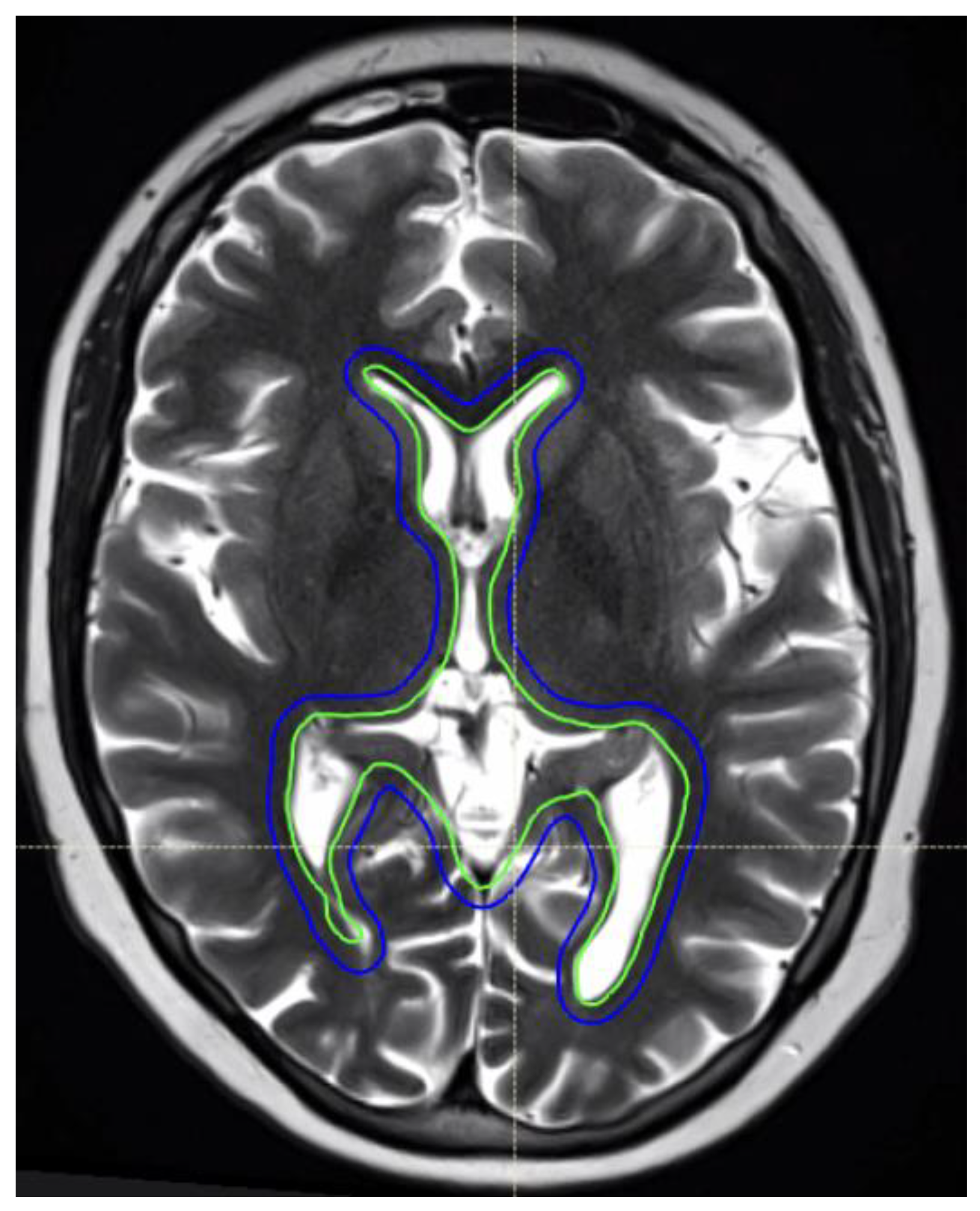 Curroncol 32 00180 g002