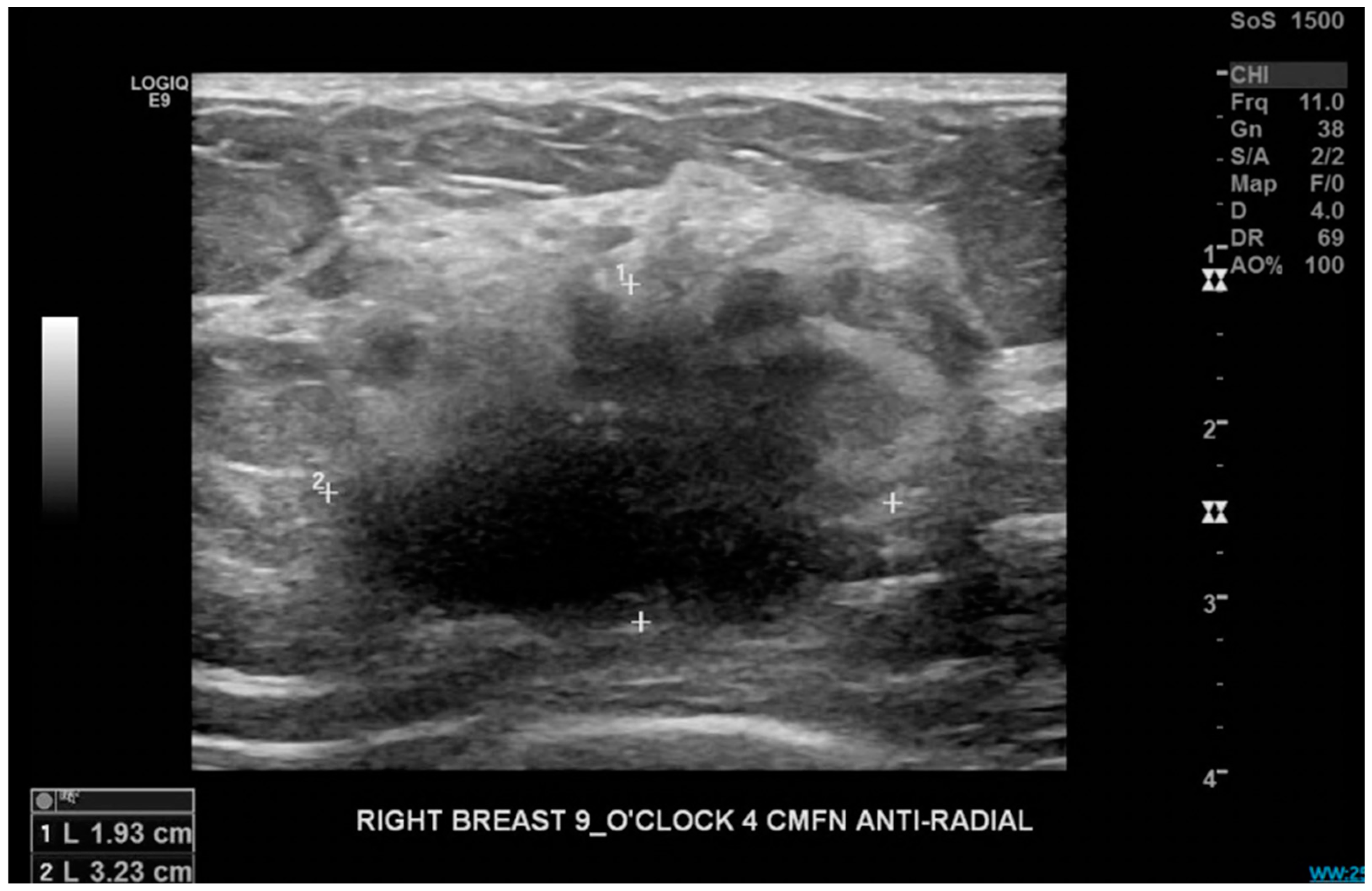 Curroncol 32 00205 sch003