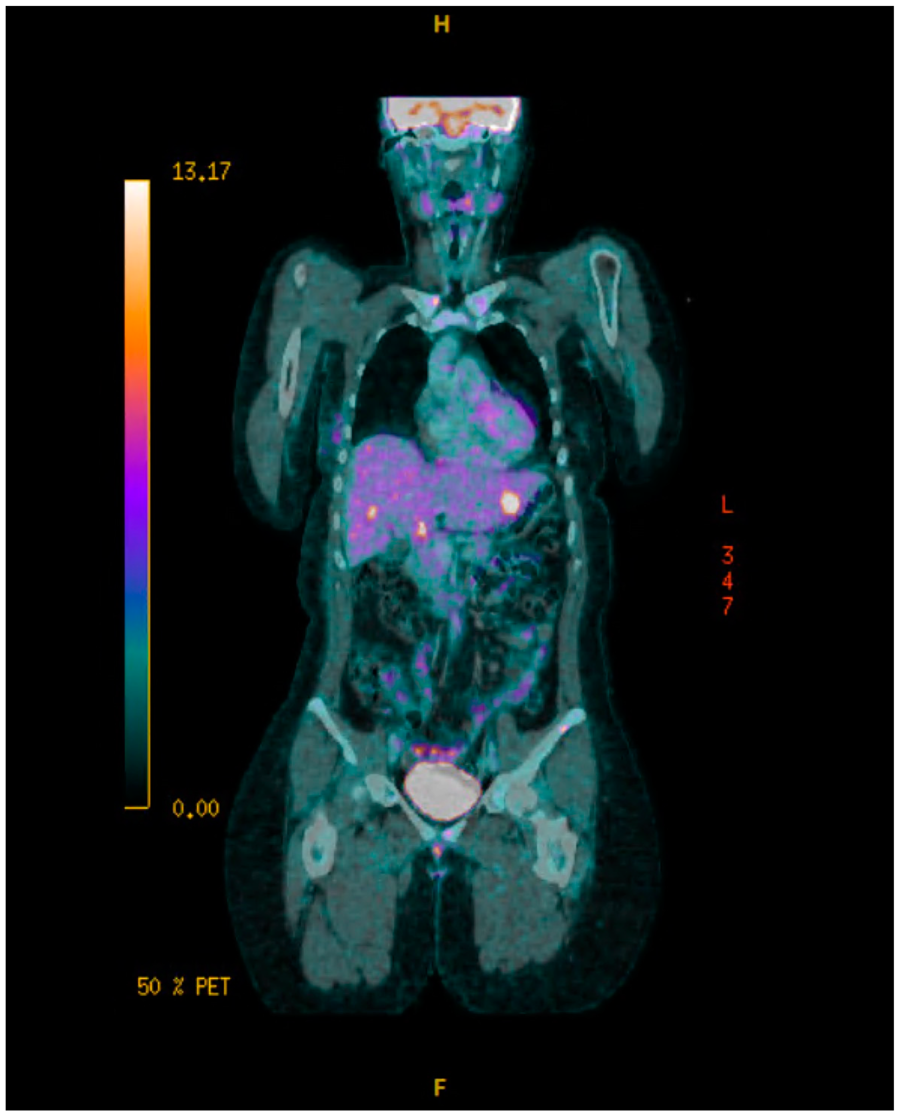 Curroncol 32 00205 sch004