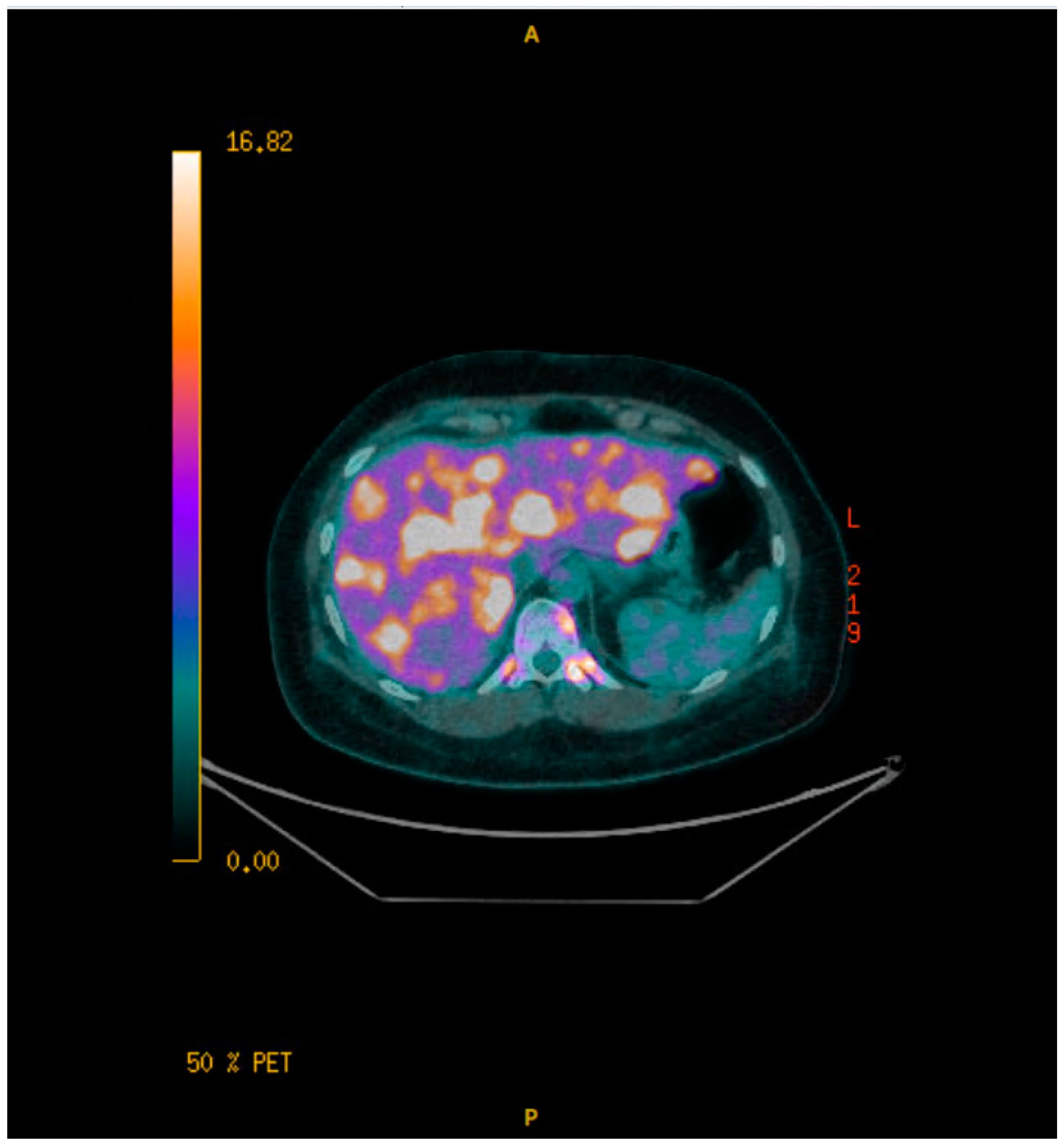 Curroncol 32 00205 sch005