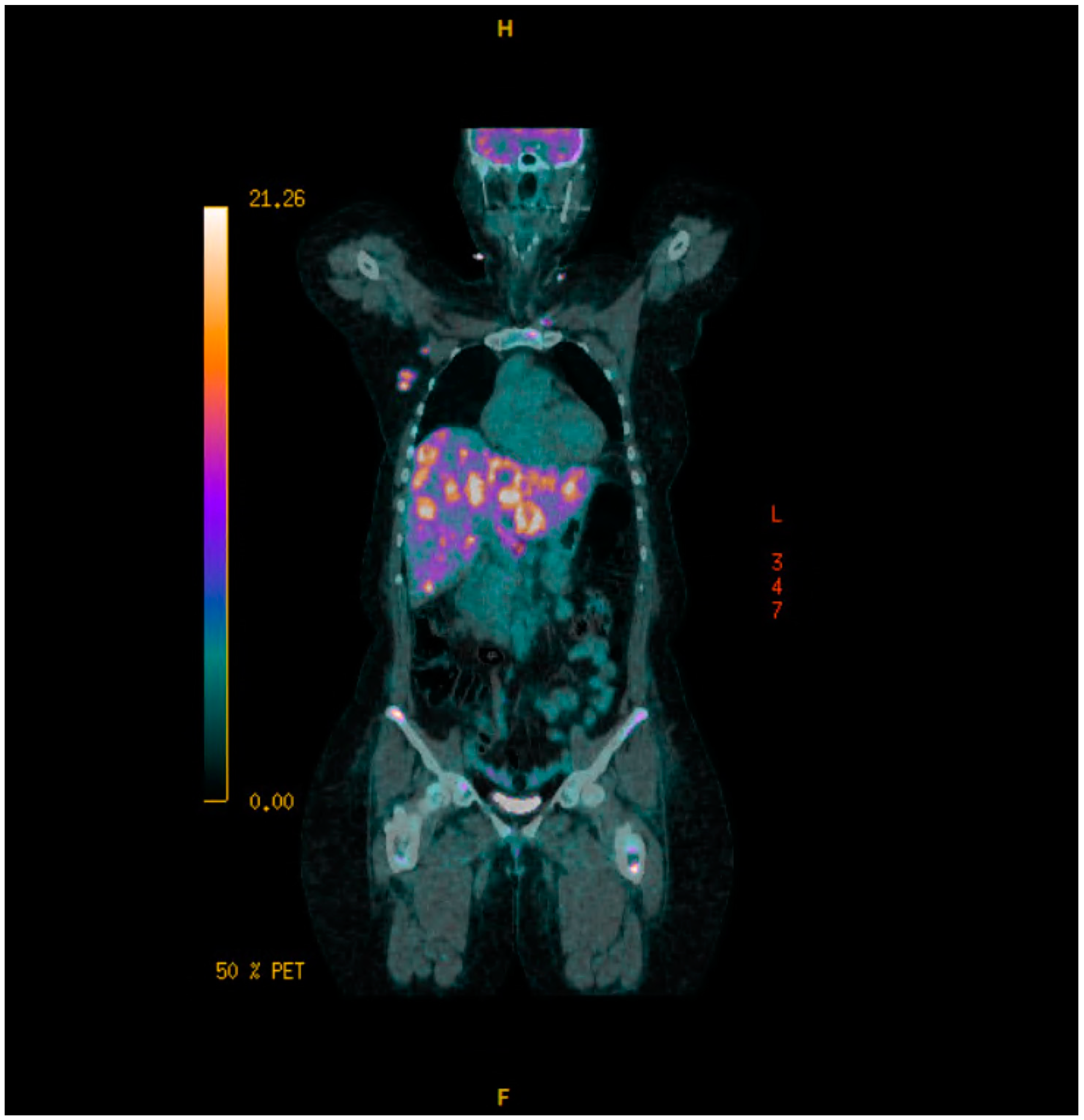 Curroncol 32 00205 sch006