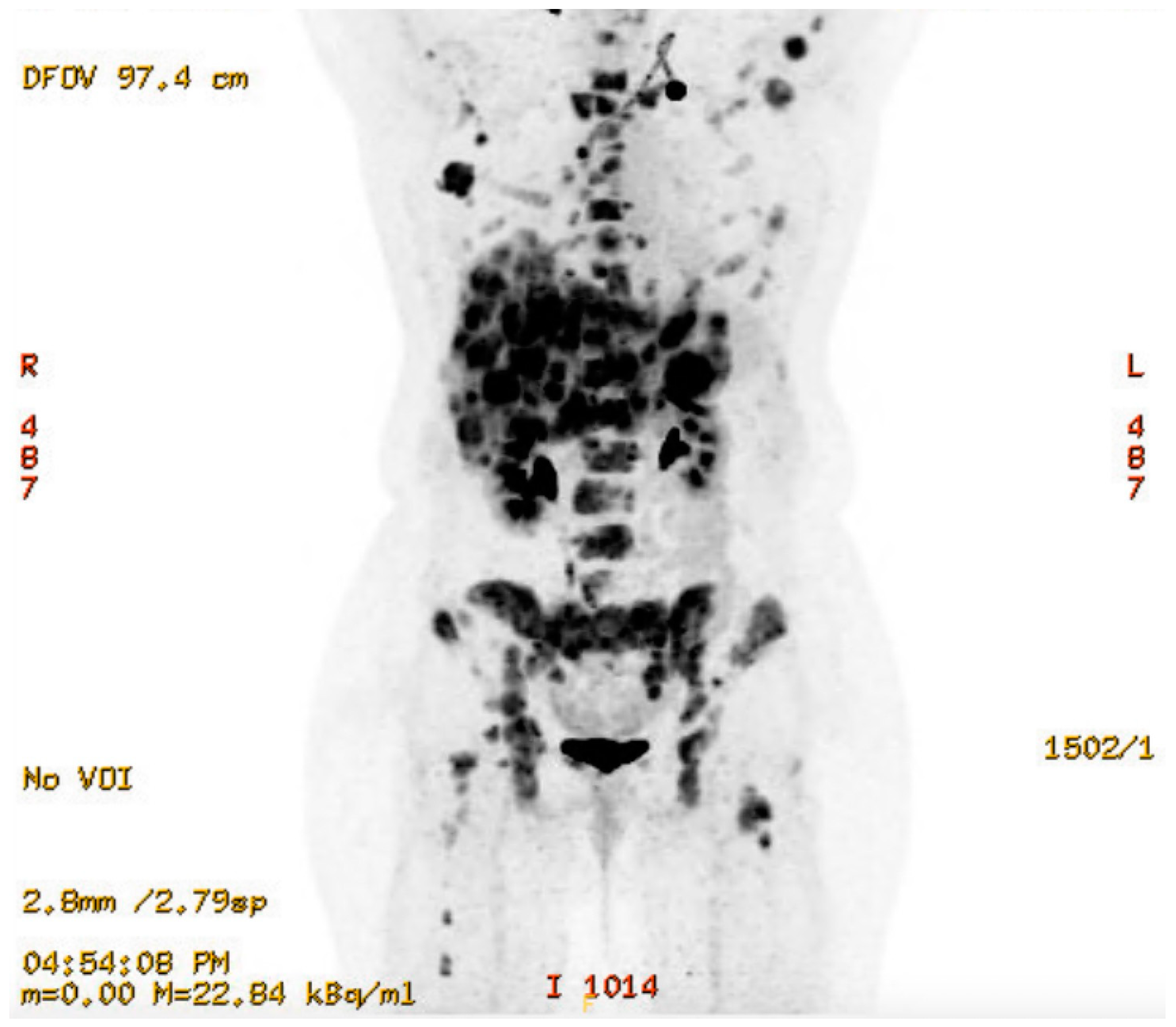 Curroncol 32 00205 sch007