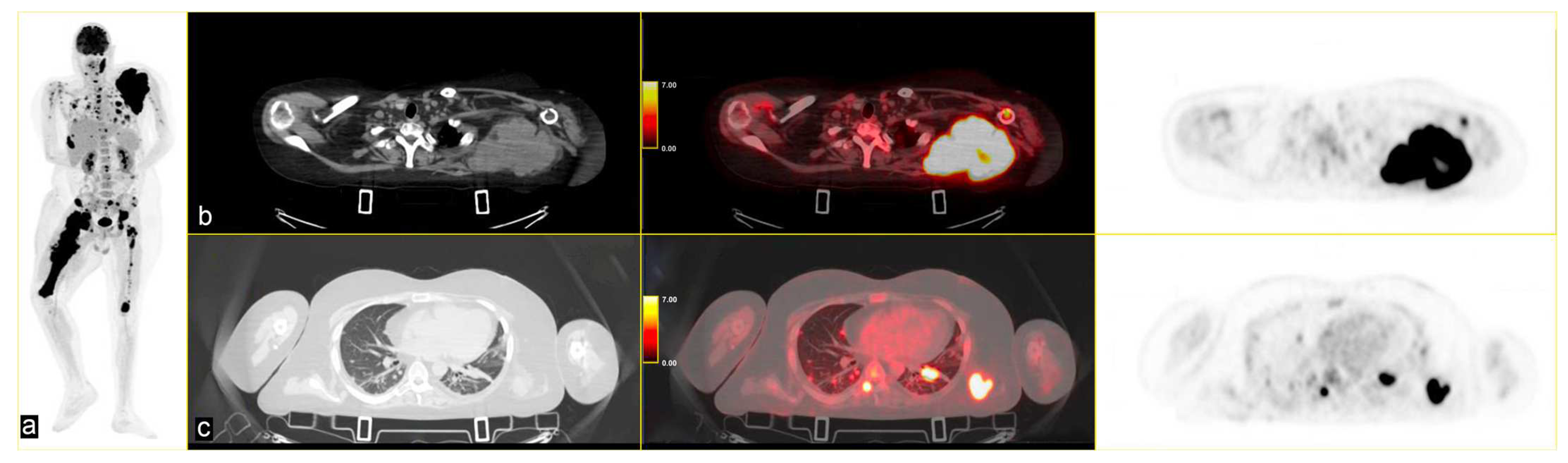Curroncol 32 00219 g004