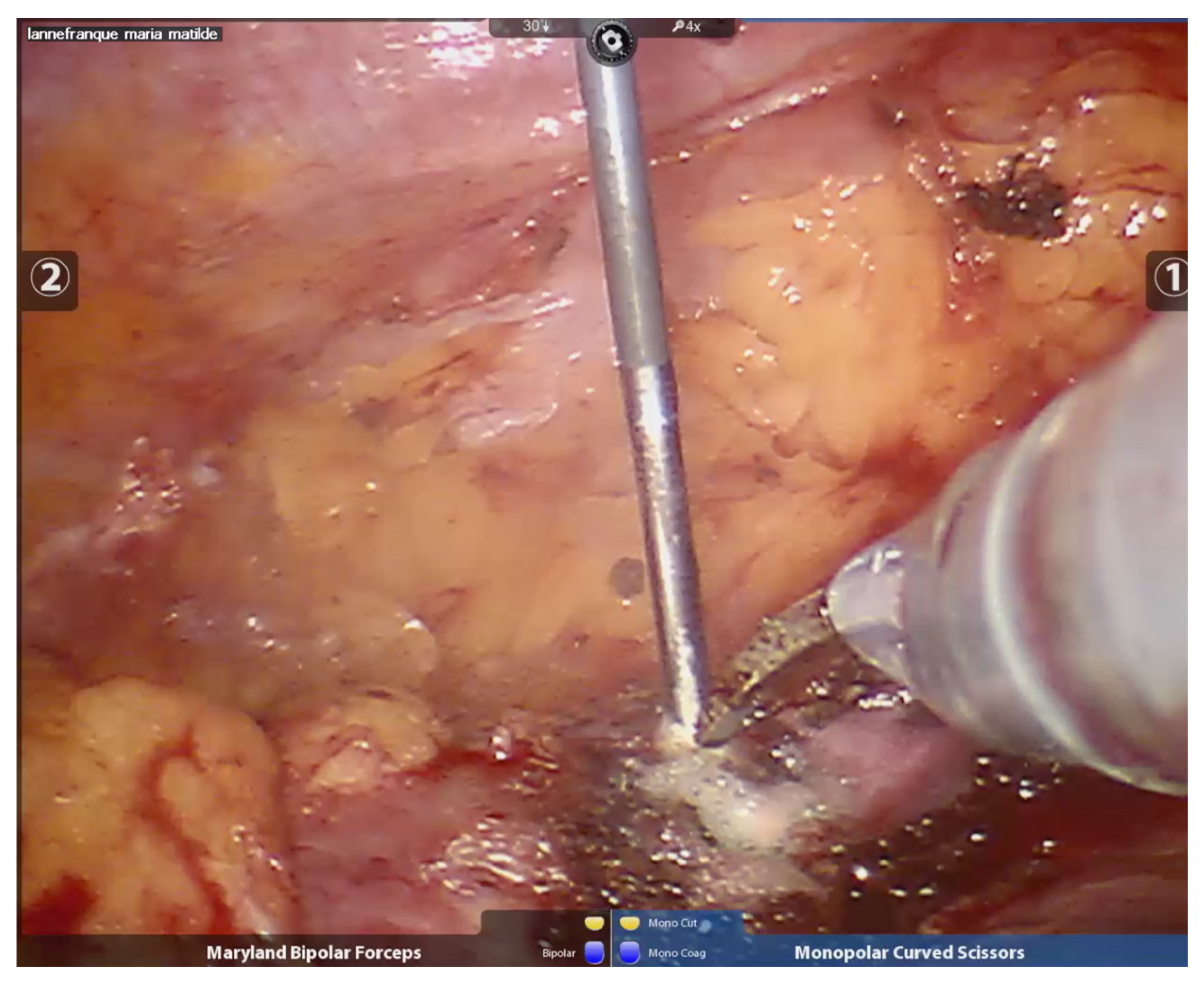 Curroncol 32 00246 g005