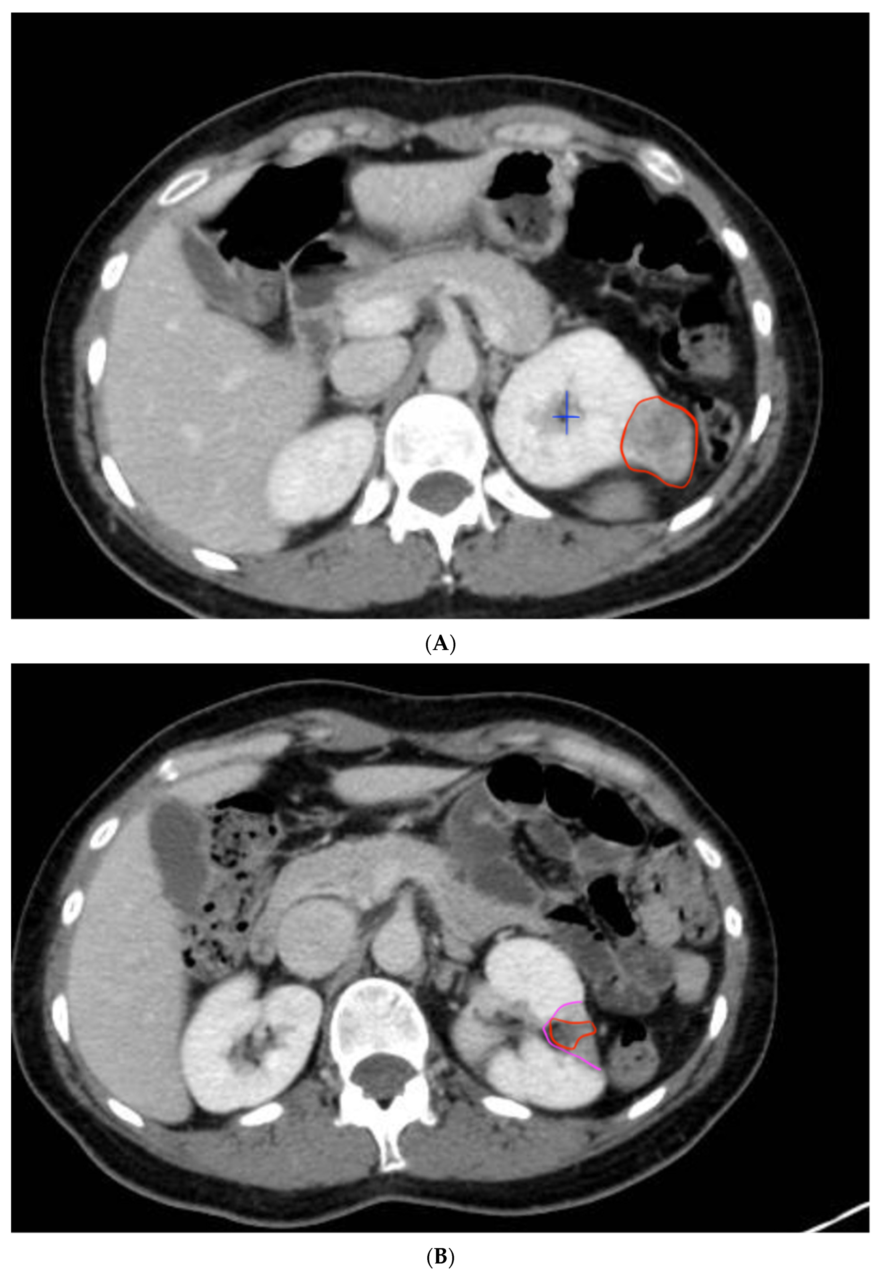 Curroncol 32 00246 g006
