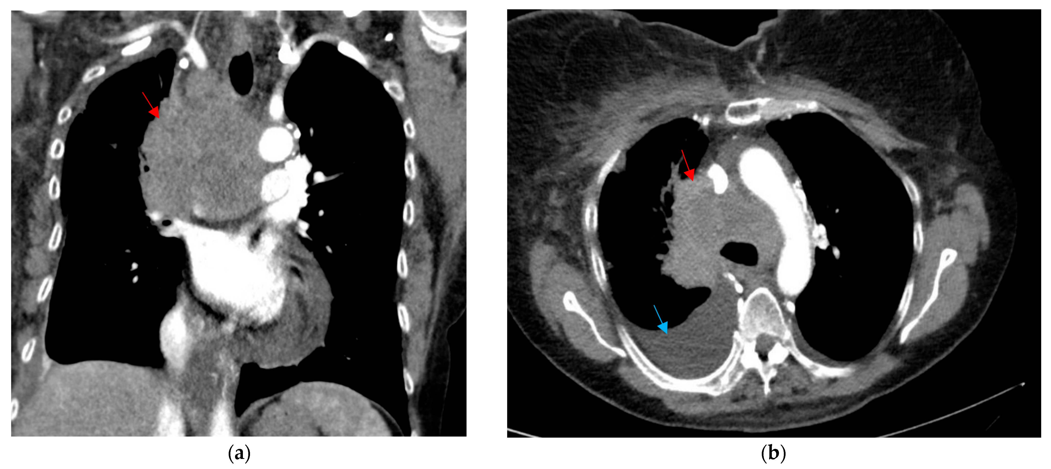 Curroncol 32 00366 g001