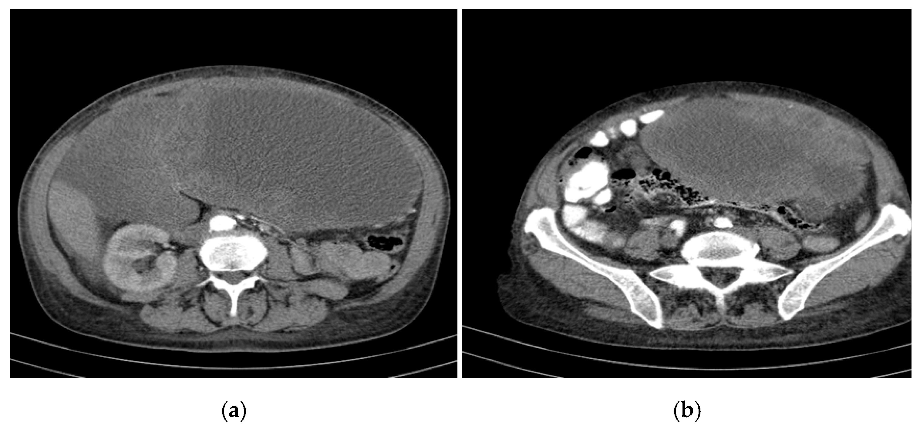 Curroncol 32 00383 g002