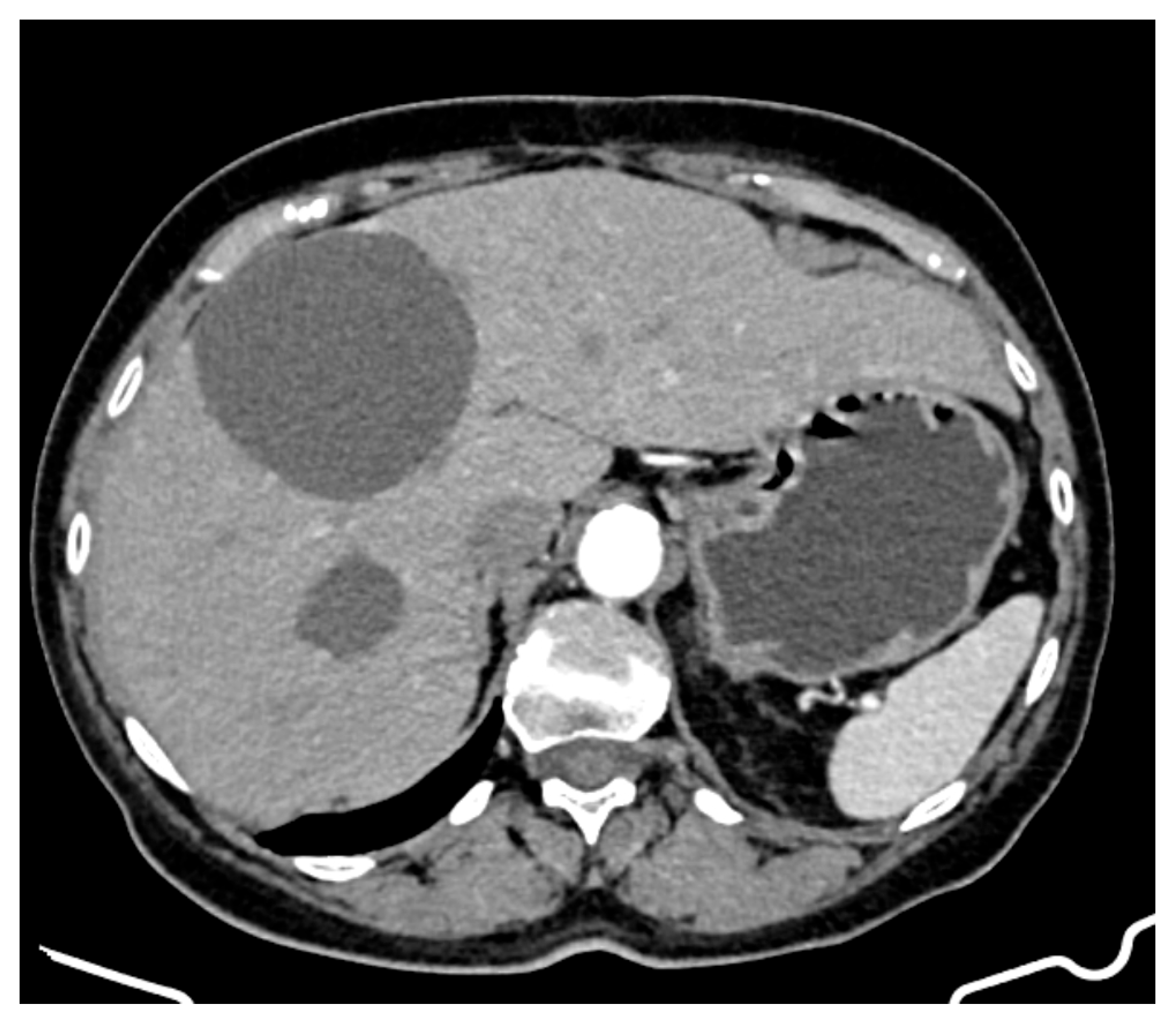 Curroncol 32 00383 g004