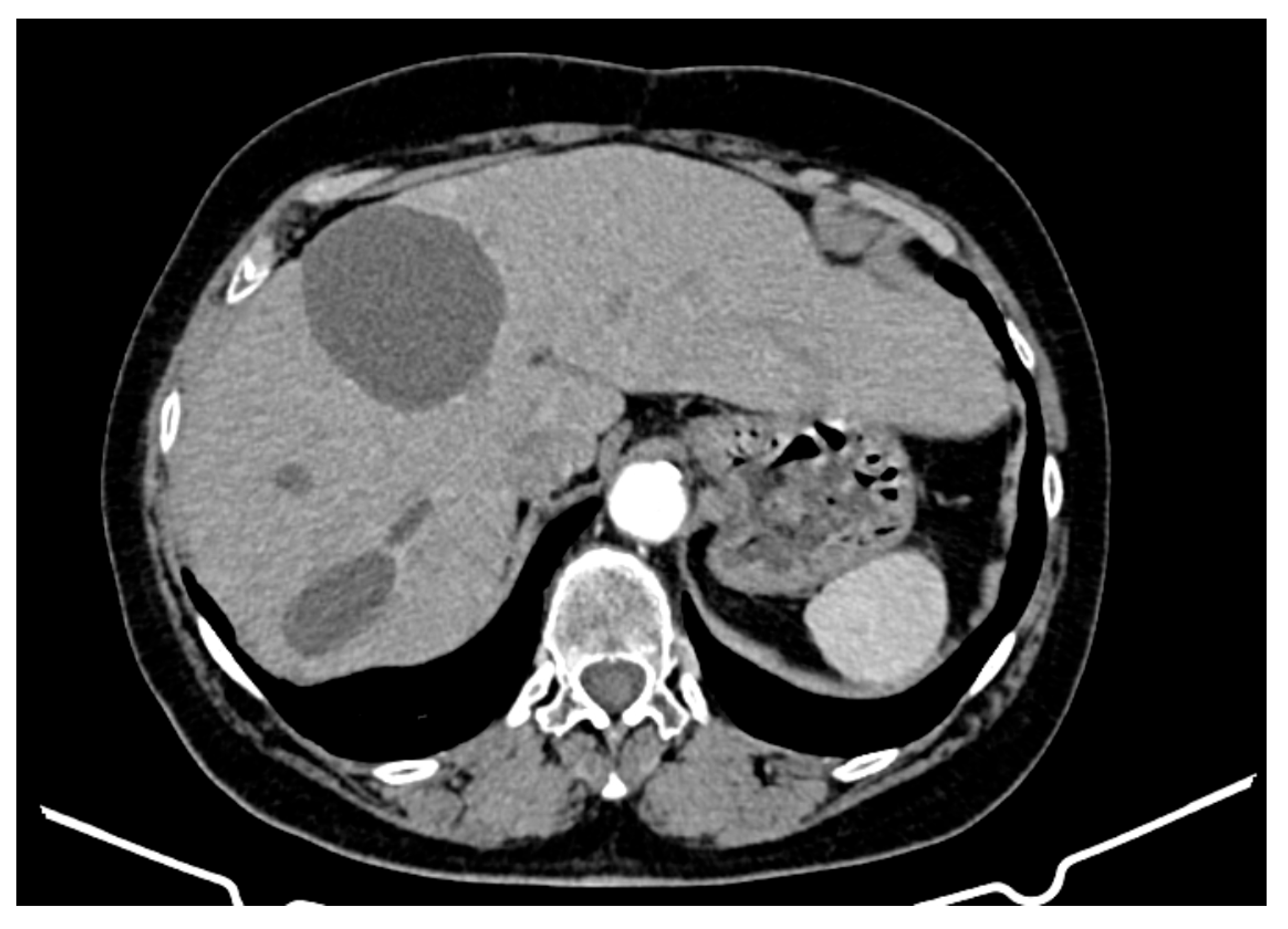 Curroncol 32 00383 g005