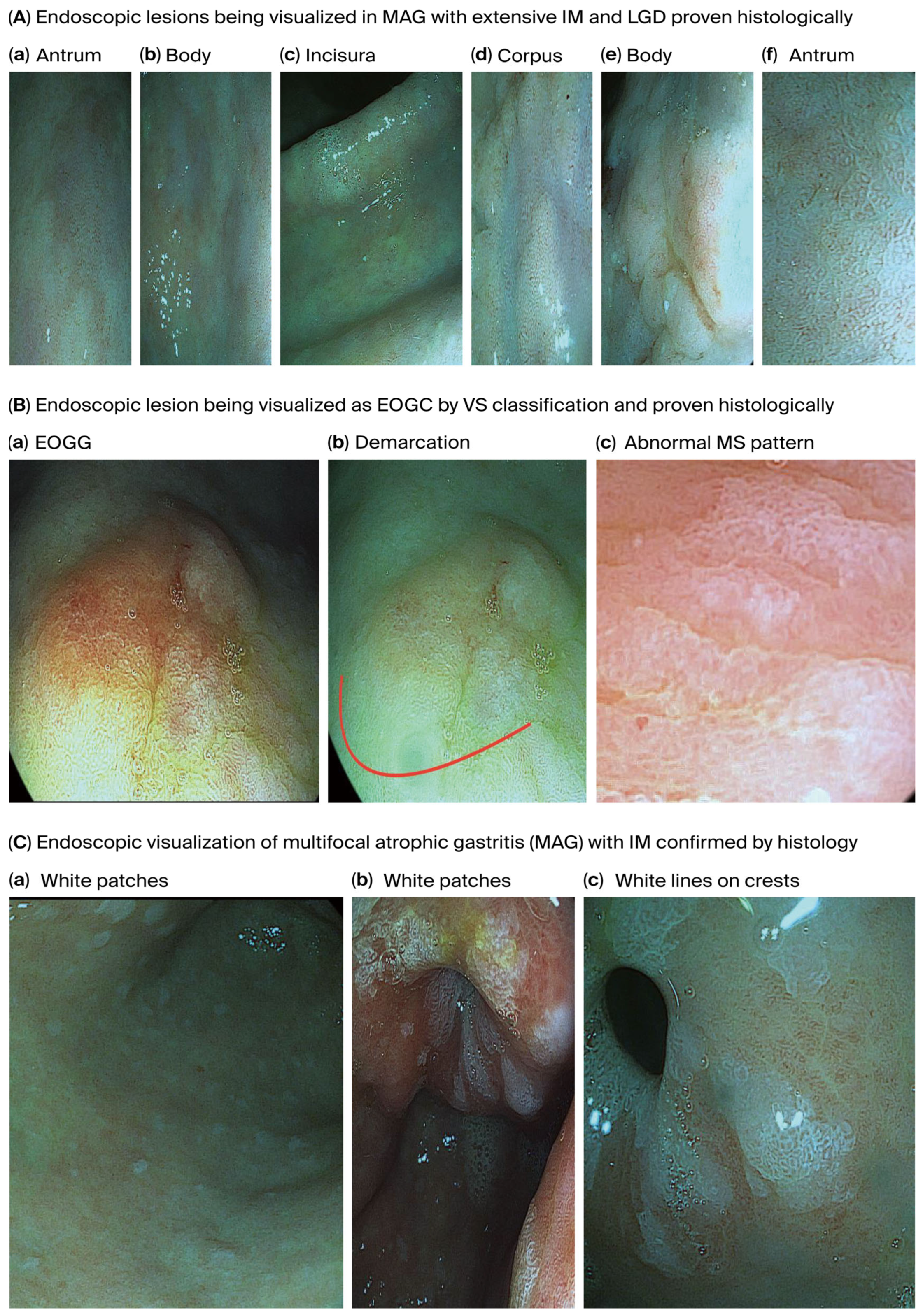 Curroncol 32 00428 g003
