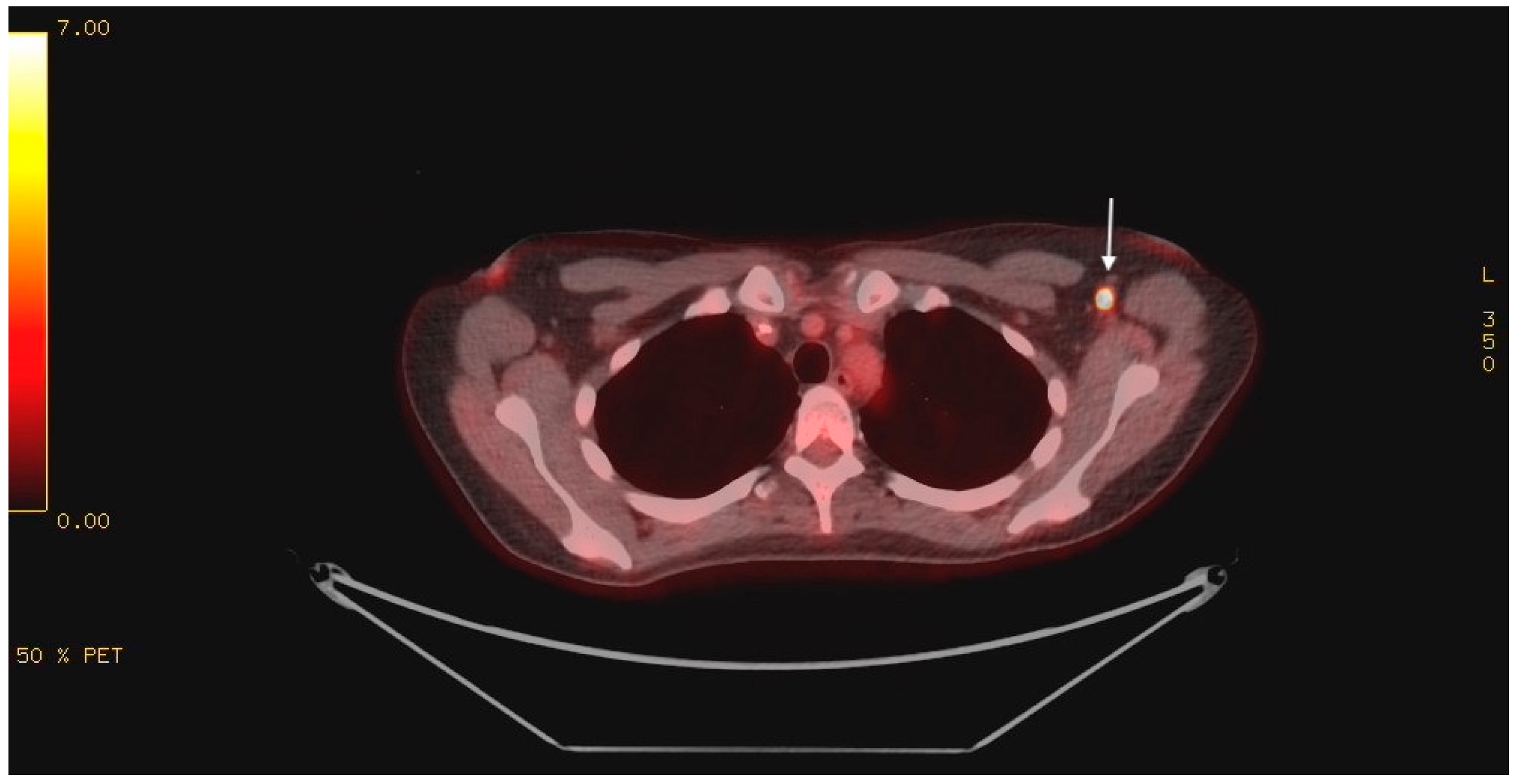 Curroncol 32 00440 g001 Curroncol 32 00440 g001